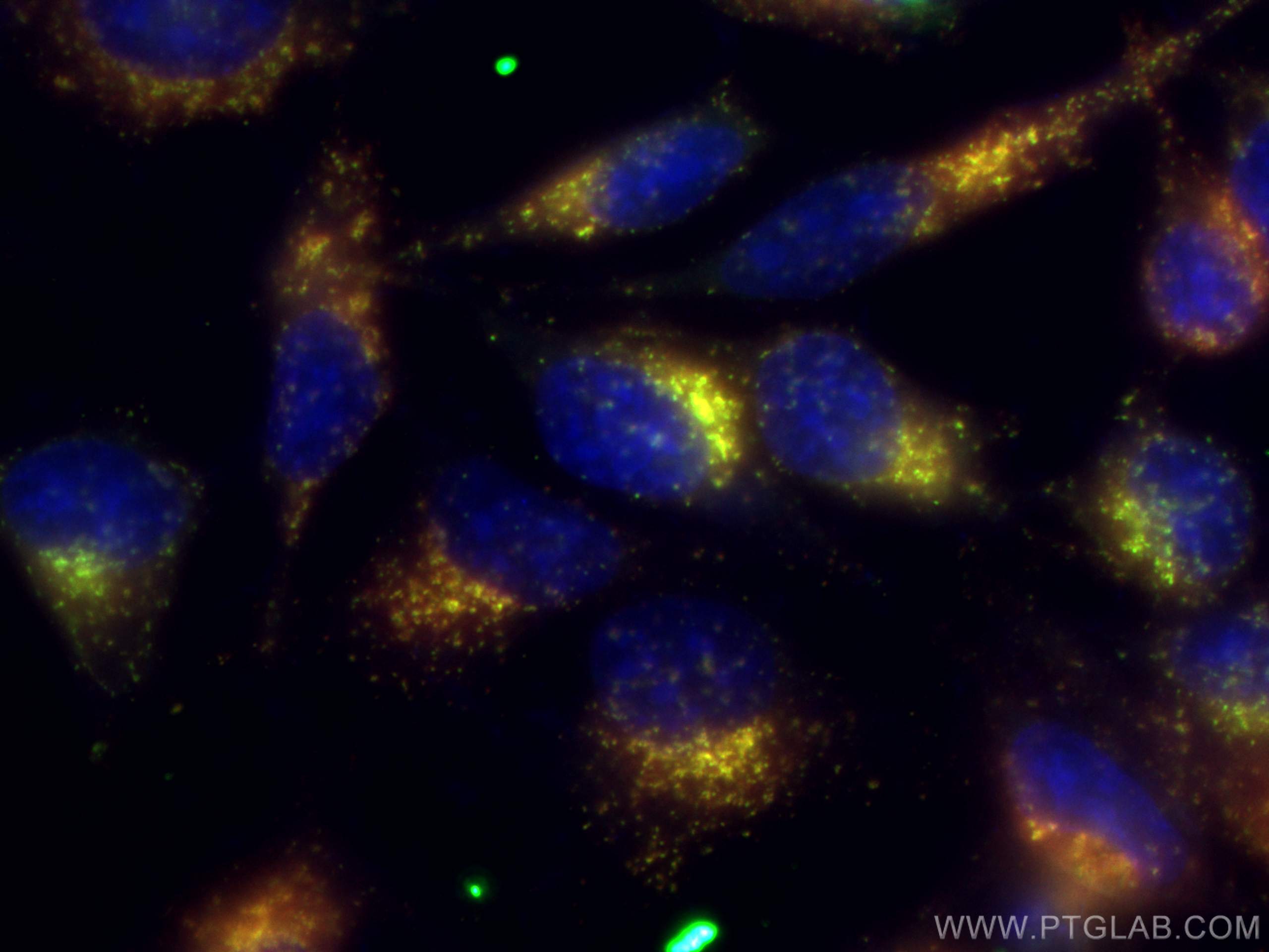 Immunofluorescence (IF) / fluorescent staining of HeLa cells using CoraLite®647 Anti-Human CD107b / LAMP2 (H4B4) (CL647-65053)
