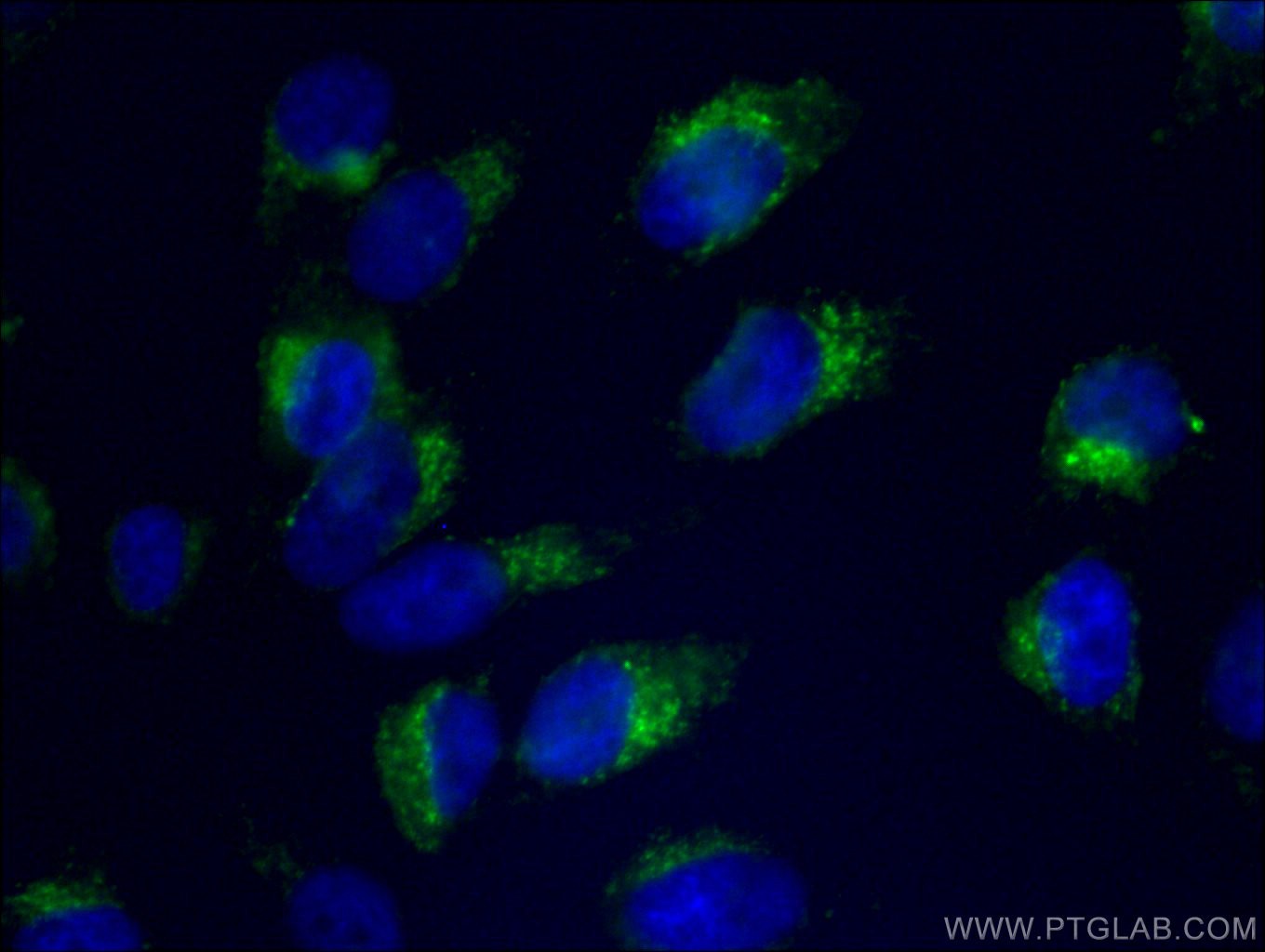 Immunofluorescence (IF) / fluorescent staining of HeLa cells using FITC Plus Anti-Human CD107b / LAMP2 (H4B4) (FITC-65053)