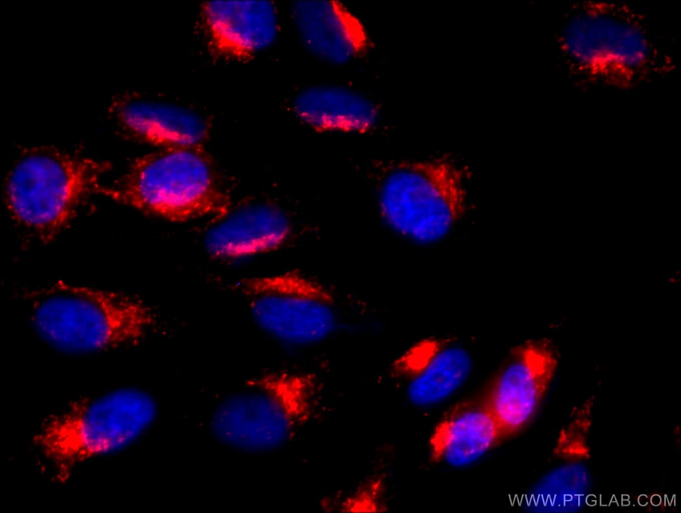 Immunofluorescence (IF) / fluorescent staining of HeLa cells using PE Anti-Human CD107b / LAMP2 (H4B4) (PE-65053)