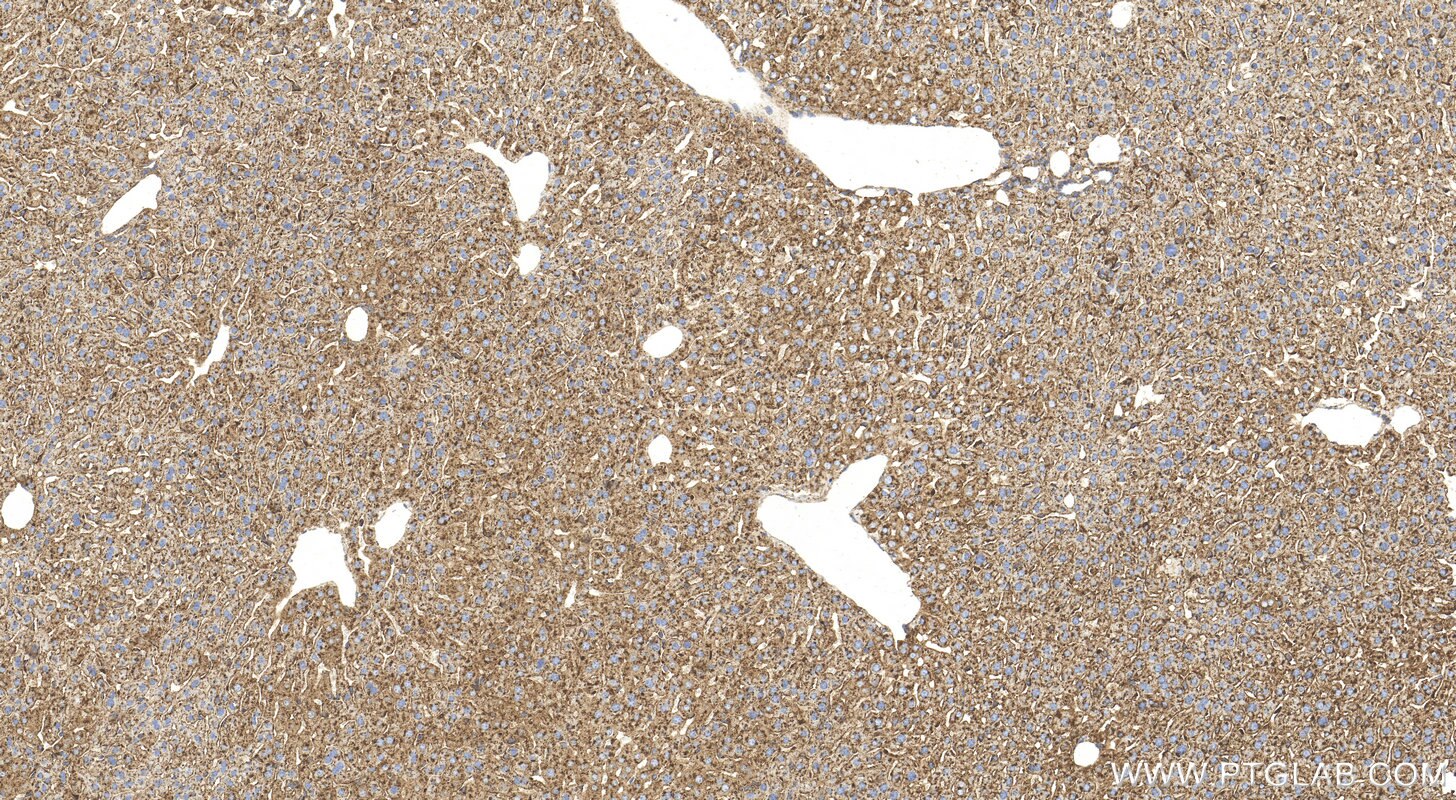 Immunohistochemistry (IHC) staining of mouse liver tissue using CD107b / LAMP2 Polyclonal antibody (32148-1-AP)