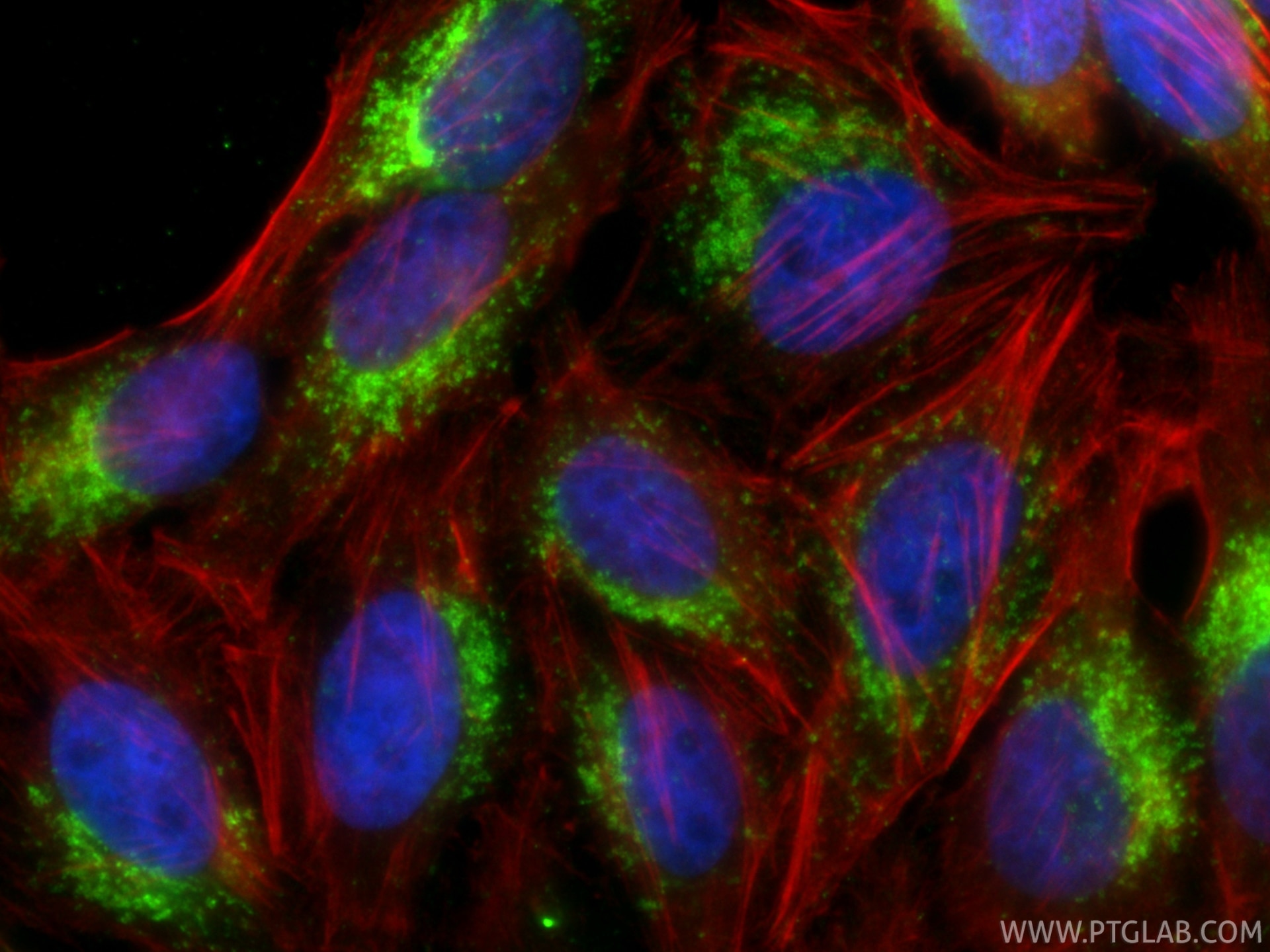 IF Staining of HepG2 using 34523-1-AP Immunofluorescence (IF) / fluorescent staining of HepG2 cells using CD107b / LAMP2 Polyclonal antibody (34523-1-AP)