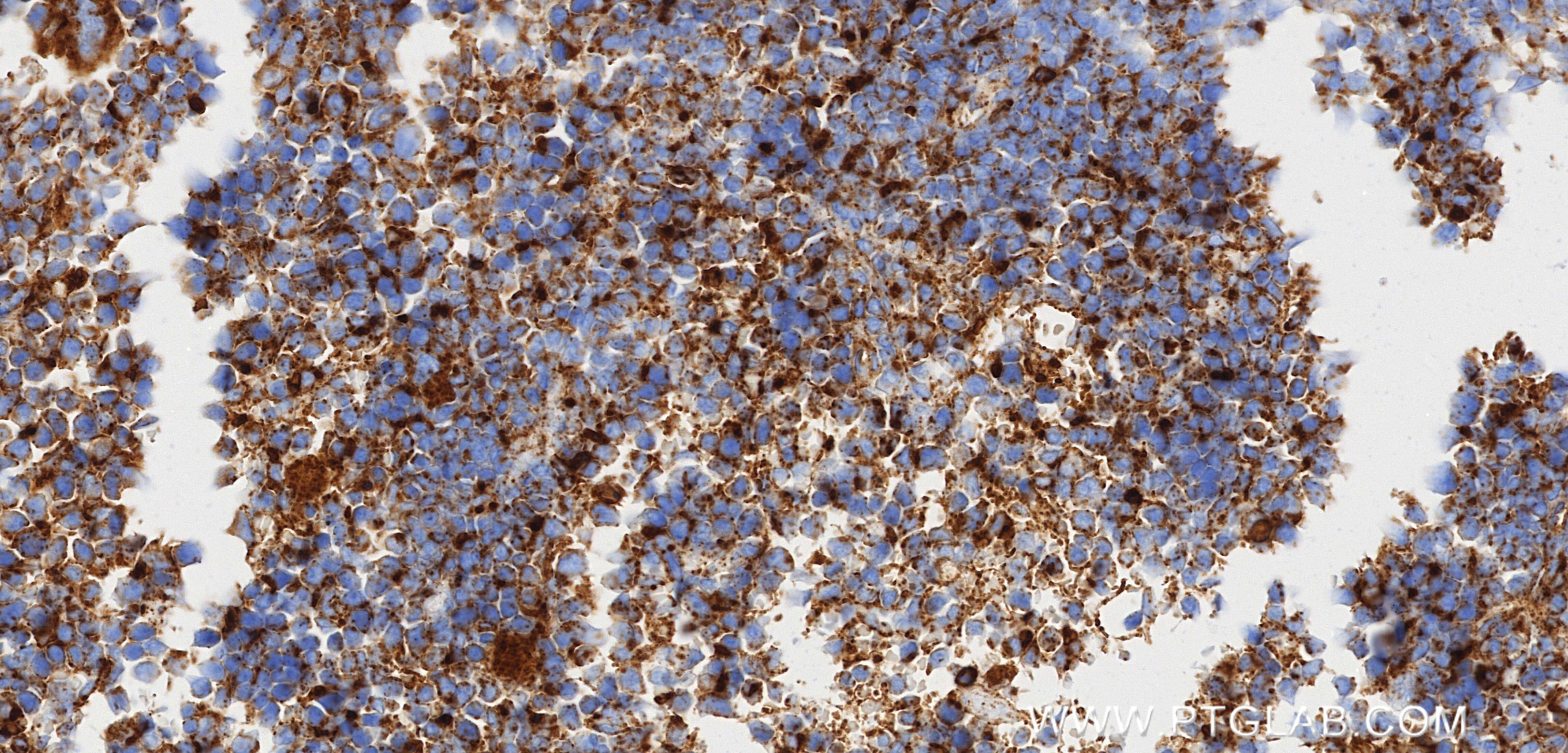 Immunohistochemistry (IHC) staining of mouse spleen tissue using CD107b / LAMP2 Recombinant monoclonal antibody (84474-5-RR)