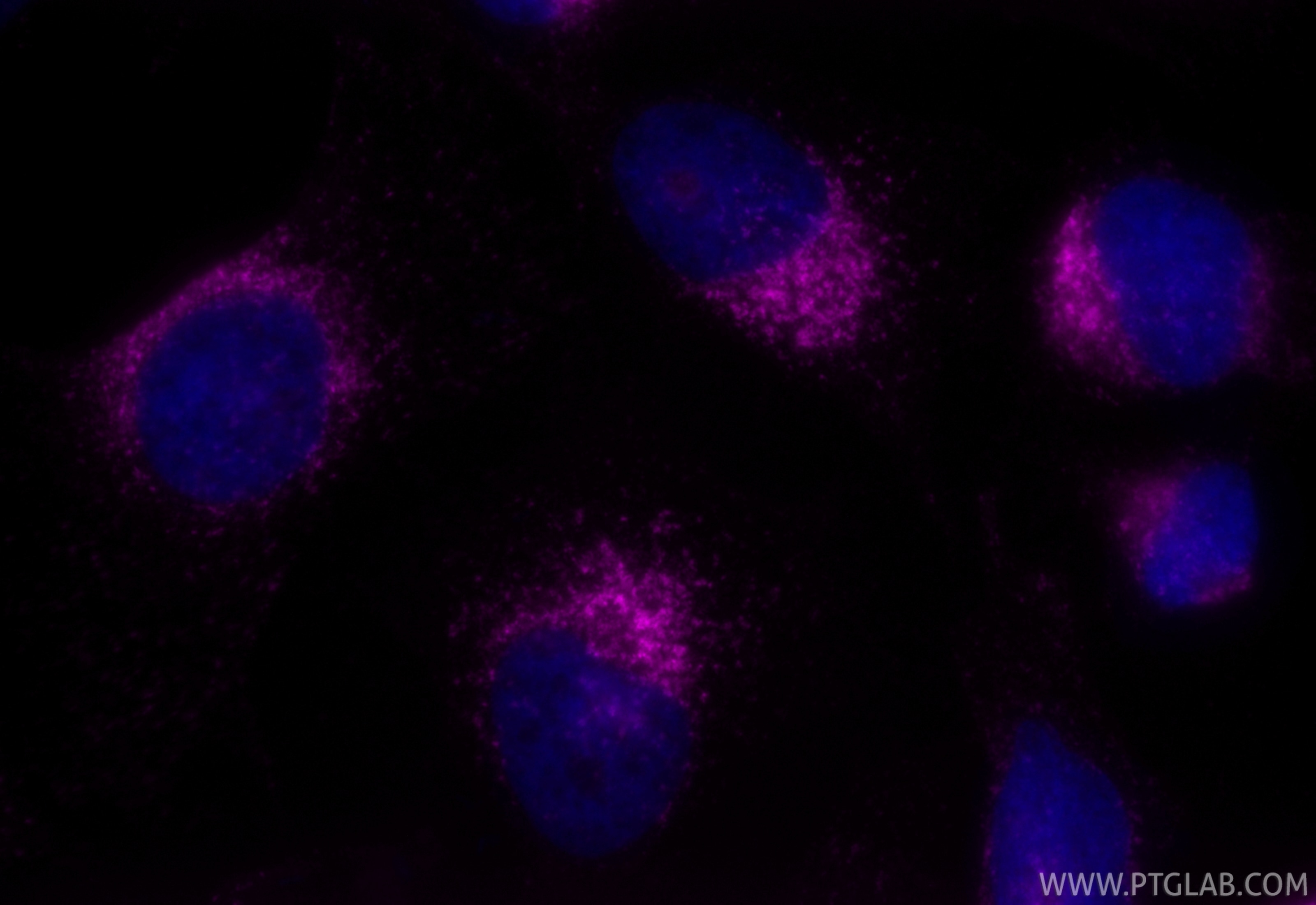 IF Staining of HeLa using APC-FcA65566 Immunofluorescence (IF) / fluorescent staining of HeLa cells using FcZero-rAb® APC Anti-Human CD107b / LAMP2 (H4B4) R (APC-FcA65566)