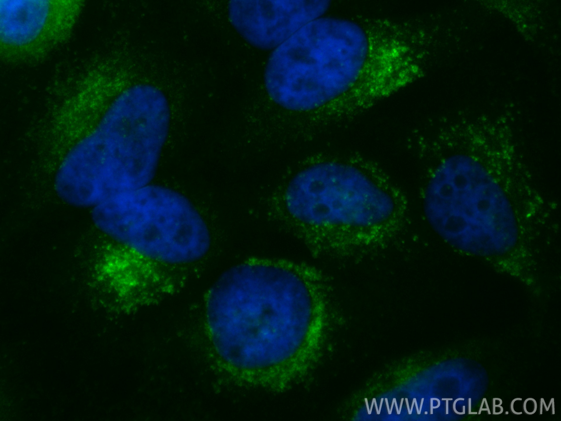 Immunofluorescence (IF) / fluorescent staining of HeLa cells using CoraLite® Plus 488 Anti-Human CD107b / LAMP2 (H4B4 (CL488-65566)