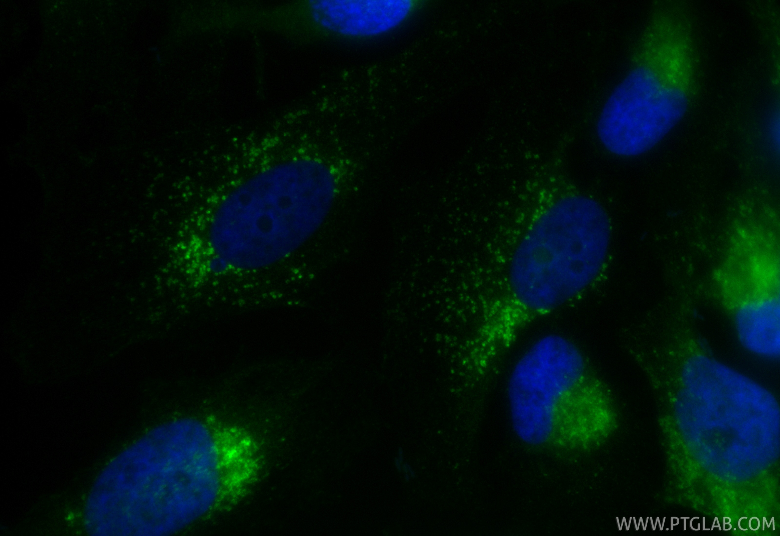 IF Staining of HeLa using CL488-FcA65566 Immunofluorescence (IF) / fluorescent staining of HeLa cells using FcZero-rAb® CoraLite® Plus 488 Anti-Human CD107b / (CL488-FcA65566)