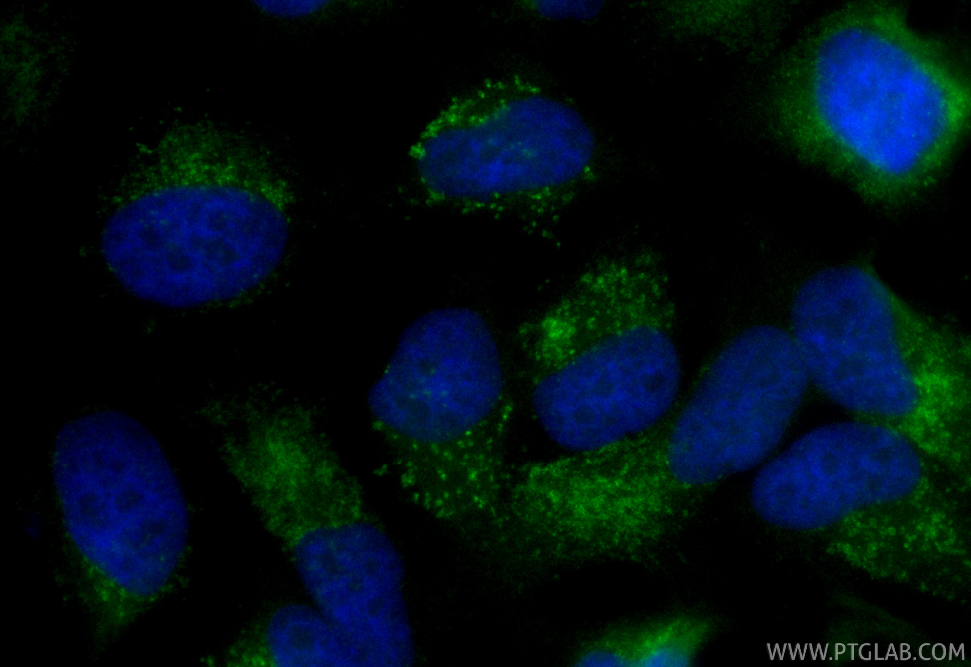 Immunofluorescence (IF) / fluorescent staining of HeLa cells using CoraLite® Plus 488 Anti-Human CD107b / LAMP2 Mouse (CL488-SF65566)