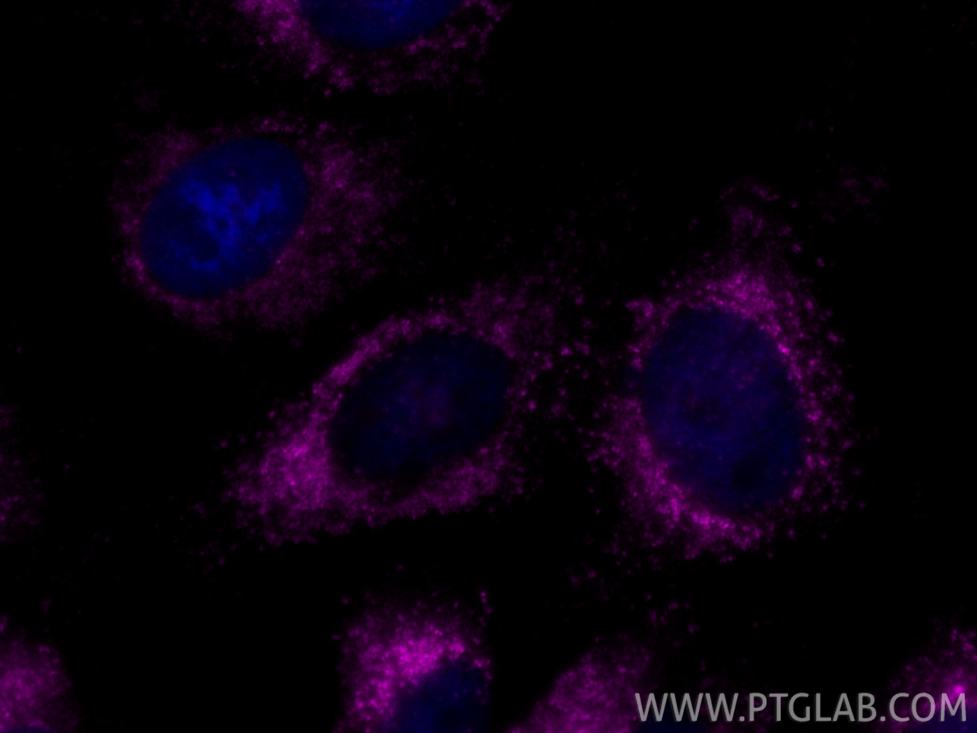 Immunofluorescence (IF) / fluorescent staining of HeLa cells using CoraLite® Plus 647 Anti-Human CD107b / LAMP2 (H4B4 (CL647-65566)
