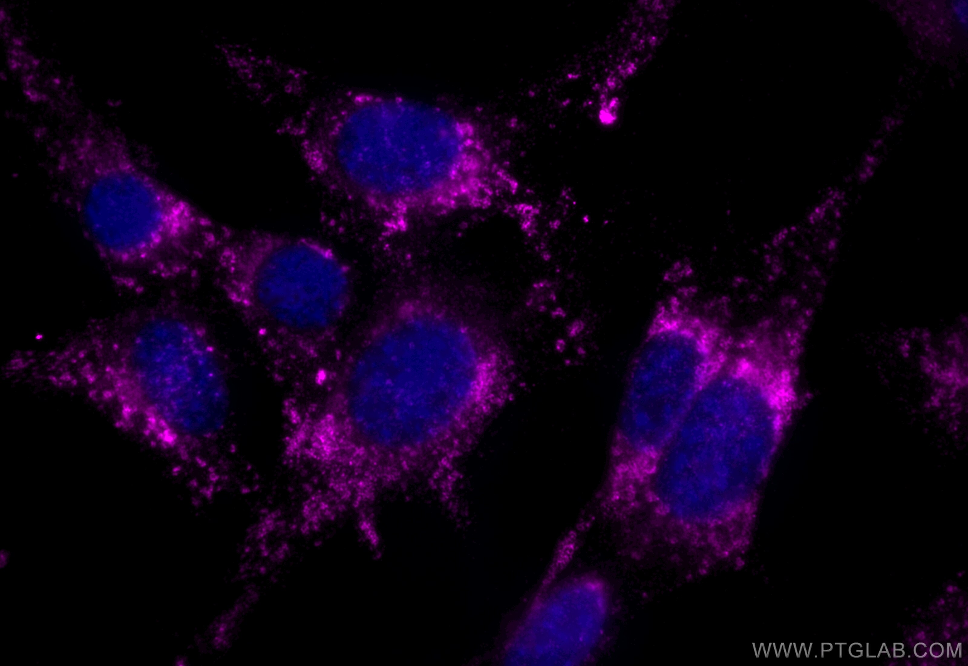 Immunofluorescence (IF) / fluorescent staining of NIH/3T3 cells using CoraLite® Plus 647-conjugated CD107b / LAMP2 Recom (CL647-84474-5)