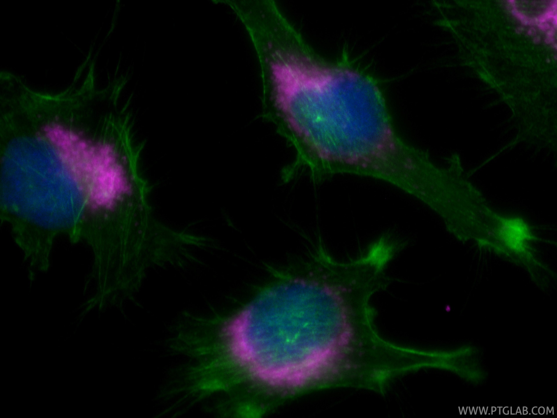 Immunofluorescence (IF) / fluorescent staining of U-251 cells using CoraLite® Plus 647-conjugated CD107b / LAMP2 Recom (CL647-86269-3)