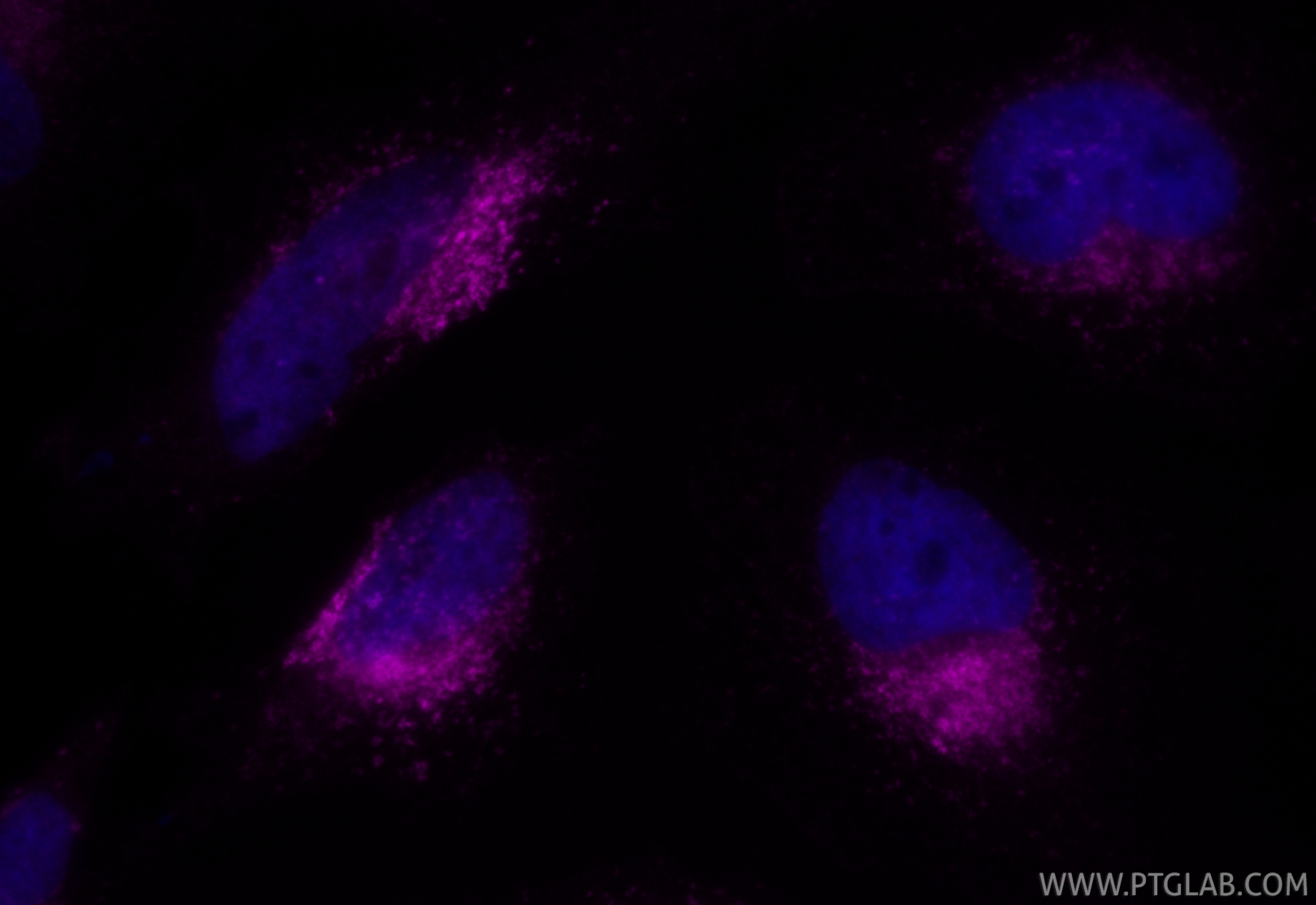 IF Staining of HeLa using CL647-FcA65566 Immunofluorescence (IF) / fluorescent staining of HeLa cells using FcZero-rAb® CoraLite® Plus 647 Anti-Human CD107b / (CL647-FcA65566)