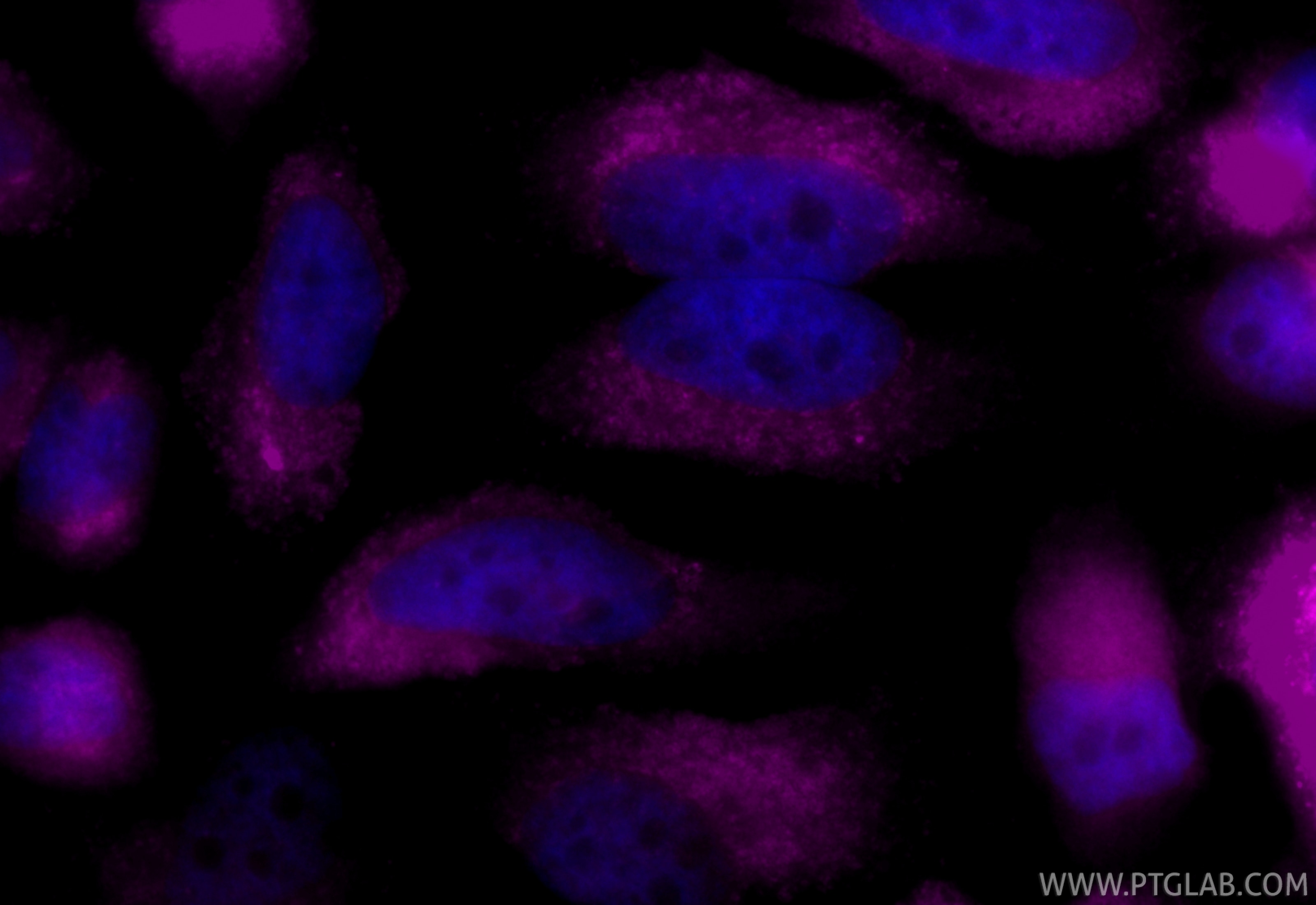 Immunofluorescence (IF) / fluorescent staining of HeLa cells using CoraLite® Plus 647 Anti-Human CD107b / LAMP2 Mouse (CL647-SF65566)