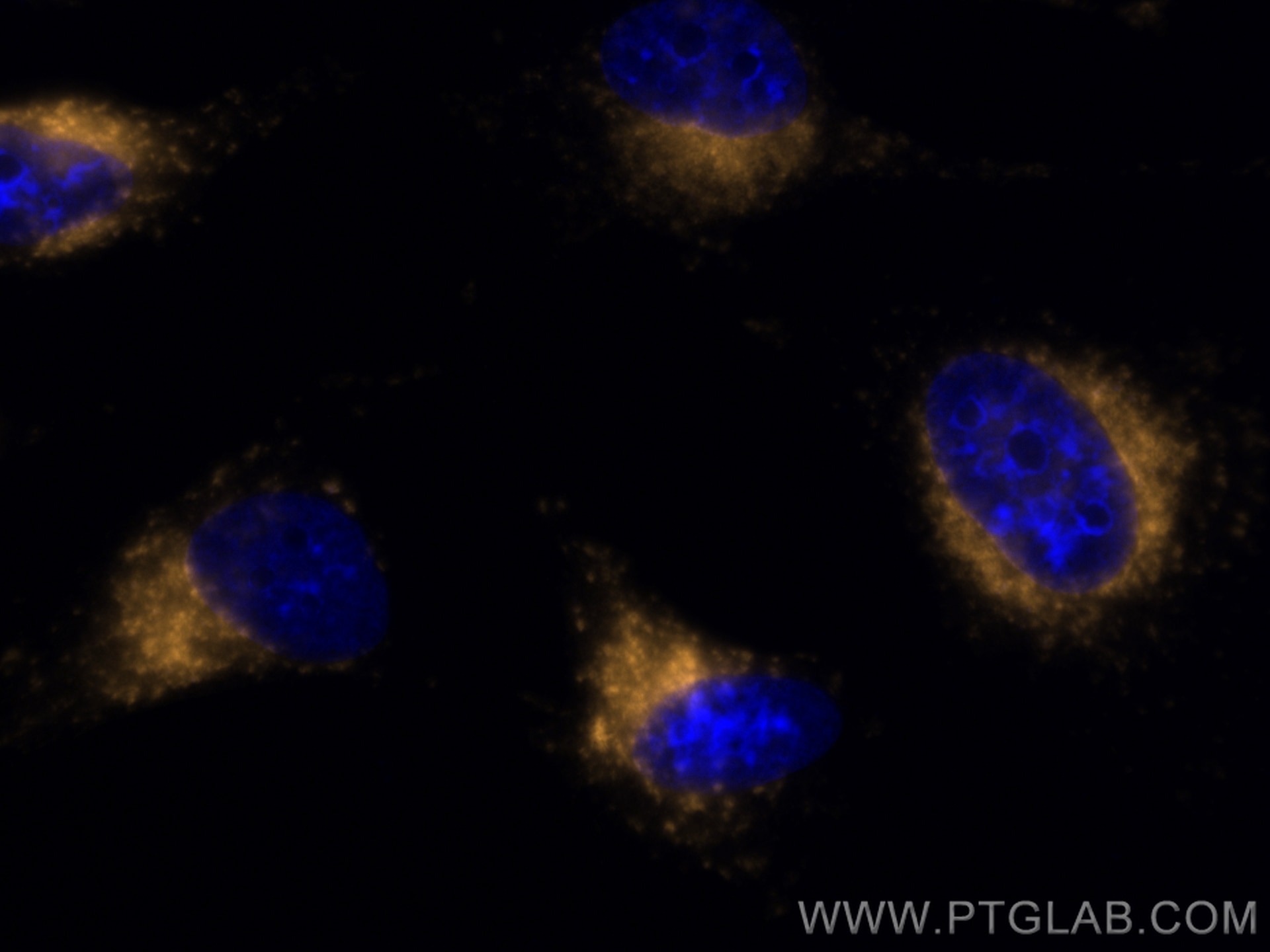 CD107b / LAMP2