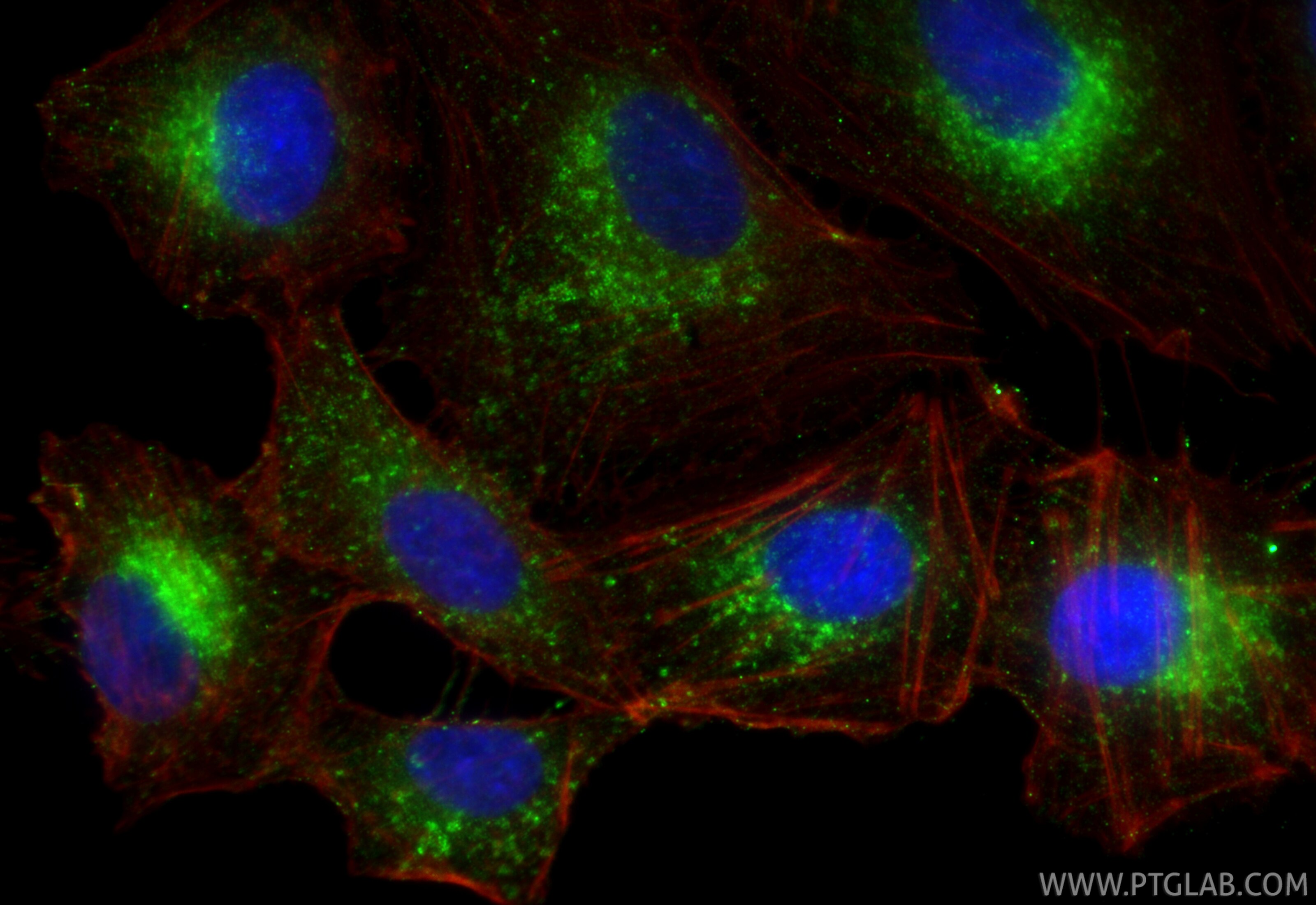 IF Staining of A549 using RMX00094 Immunofluorescence (IF) / fluorescent staining of A549 cells using Multi-rAb® CD107b / LAMP2 Multi-Recombinant antibo (RMX00094)