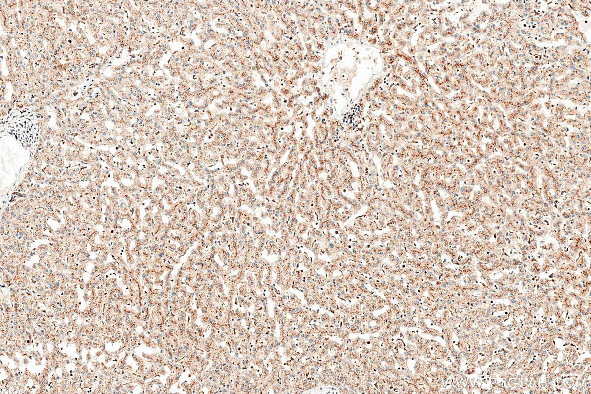 IHC staining of human liver using RMX00094 Immunohistochemistry (IHC) staining of human liver tissue using Multi-rAb® CD107b / LAMP2 Multi-Recombinant antibo (RMX00094)