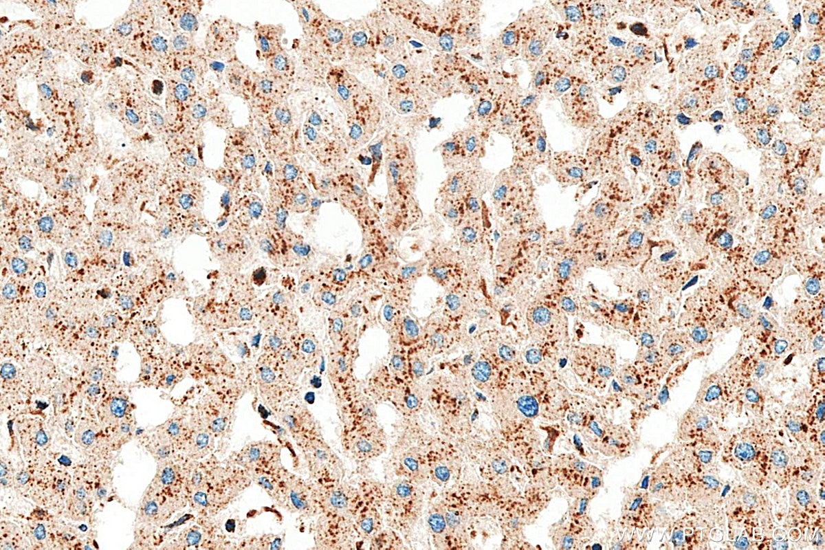 IHC staining of human liver using RMX00094 Immunohistochemistry (IHC) staining of human liver tissue using Multi-rAb® CD107b / LAMP2 Multi-Recombinant antibo (RMX00094)
