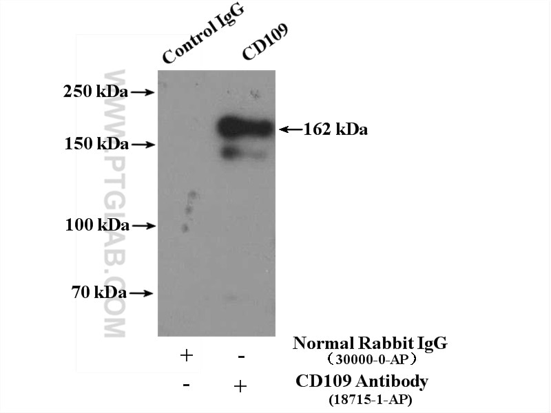 Immunoprecipitation (IP) experiment of PC-3 cells using CD109 Polyclonal antibody (18715-1-AP)