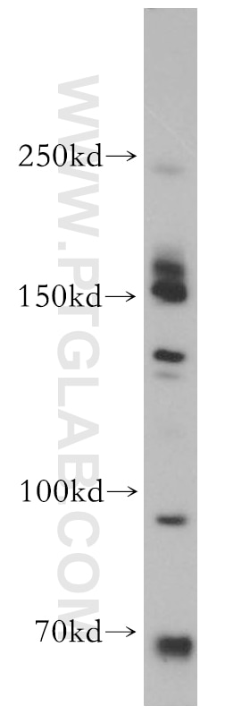 Western Blot (WB) analysis of PC-3 cells using CD109 Polyclonal antibody (18715-1-AP)