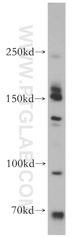 WB analysis of PC-3 using 18715-1-AP