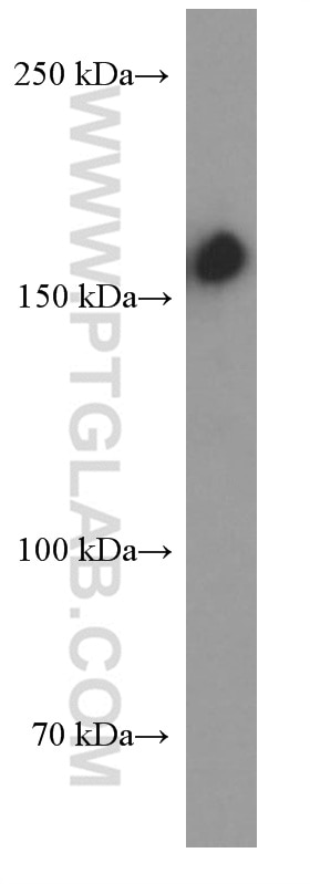 Western Blot (WB) analysis of Jurkat cells using CD109 Monoclonal antibody (60179-1-Ig)