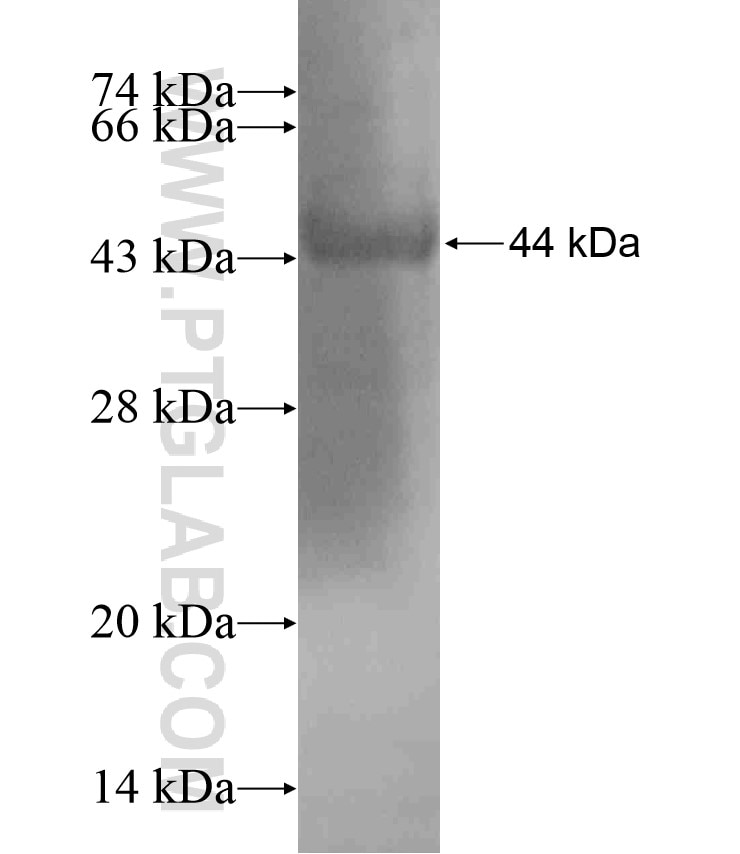 CD109 fusion protein Ag18172 SDS-PAGE