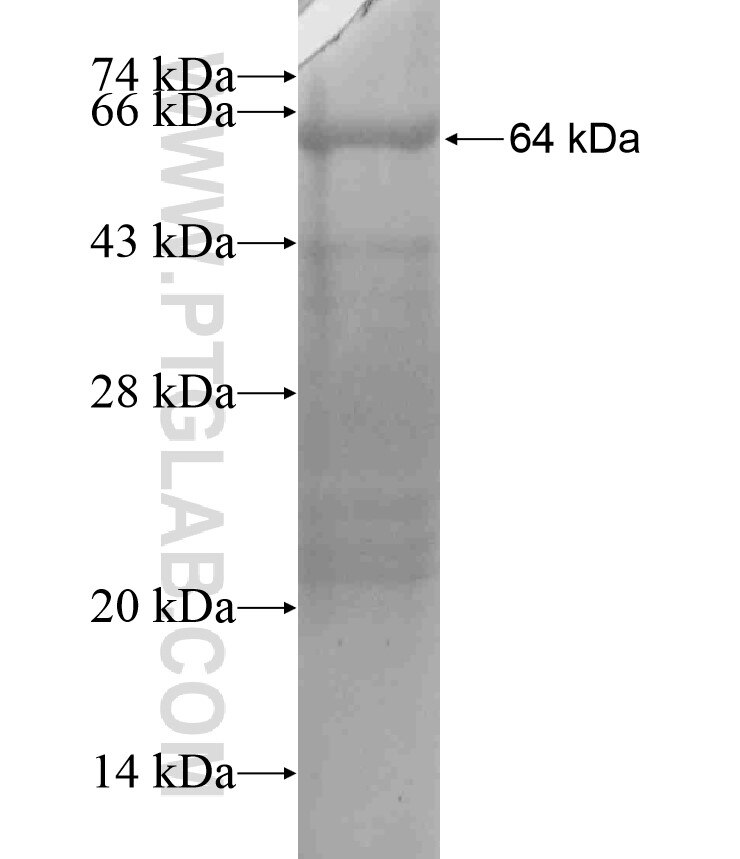 CD109 fusion protein Ag18229 SDS-PAGE