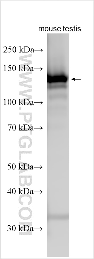Western Blot (WB) analysis of various lysates using CD117/c-Kit Polyclonal antibody (31337-1-AP)