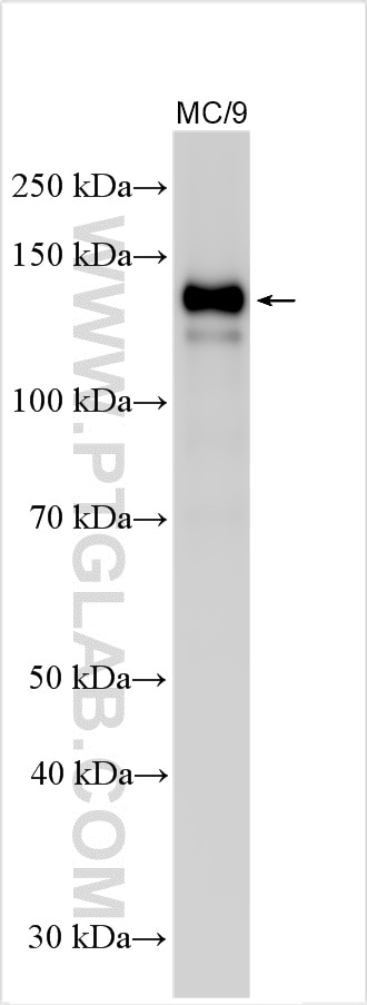 Western Blot (WB) analysis of various lysates using CD117/c-Kit Polyclonal antibody (31337-1-AP)