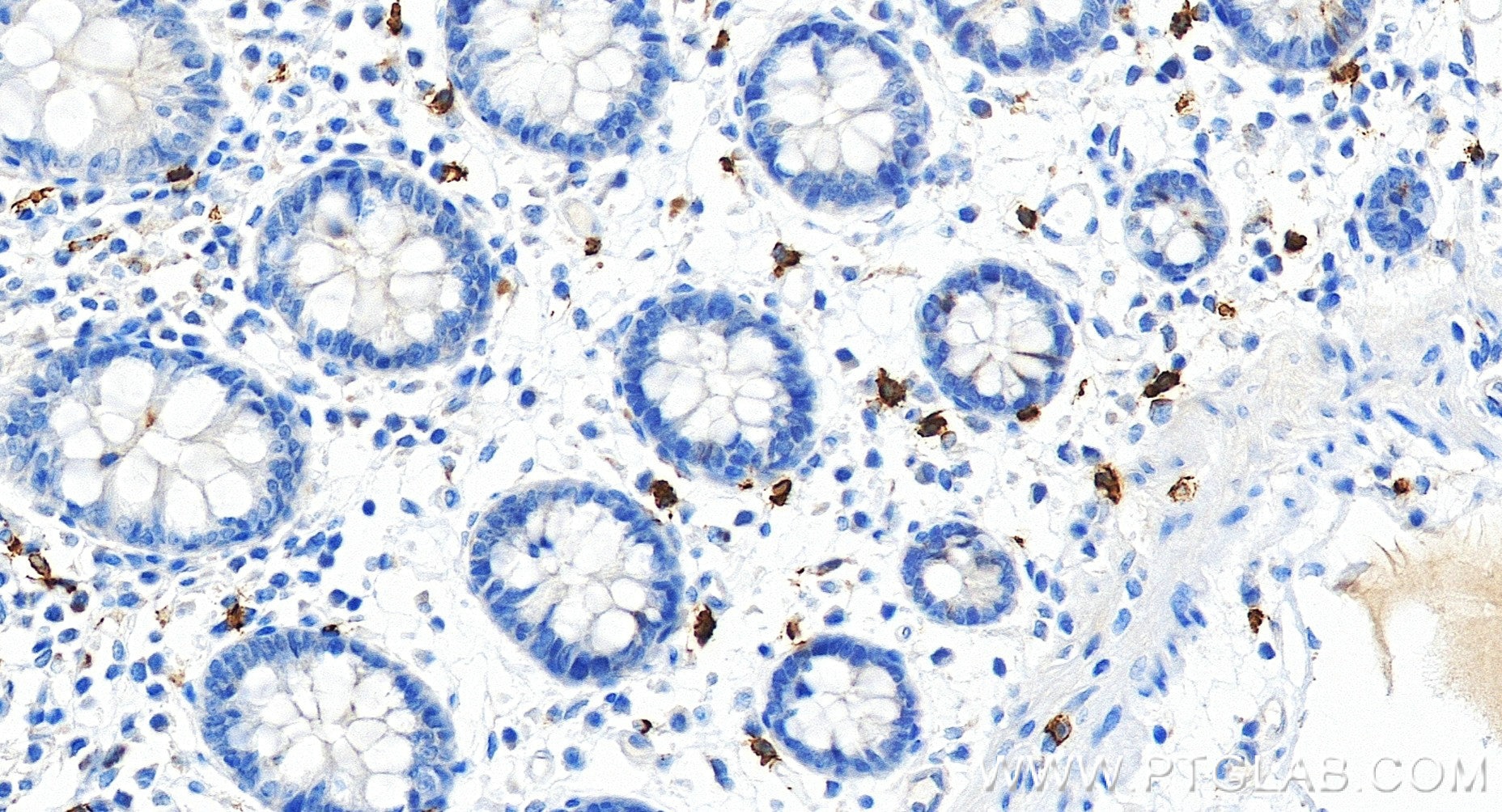 Immunohistochemistry (IHC) staining of human colon tissue using CD117/c-Kit Recombinant monoclonal antibody (84259-1-RR)
