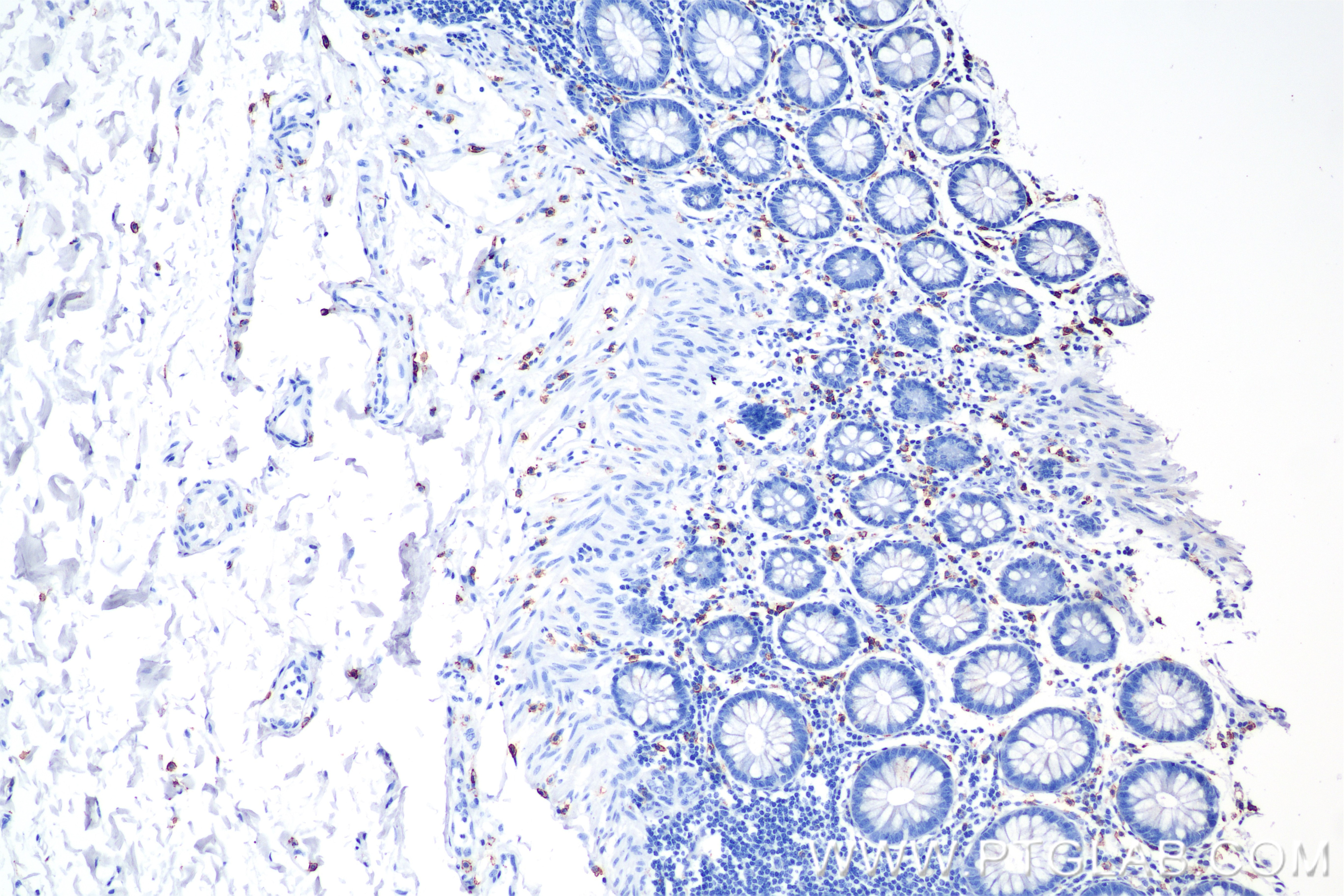 Immunohistochemical analysis of paraffin-embedded human colon tissue slide using 84259-10-RR (C-Kit antibody) at dilution of 1:5000 (under 10x lens). Heat mediated antigen retrieval with Sodium Citrate buffer (pH 6.0). Immunohistochemistry (IHC) staining of human colon tissue using CD117/c-Kit Recombinant antibody (84259-10-RR)
