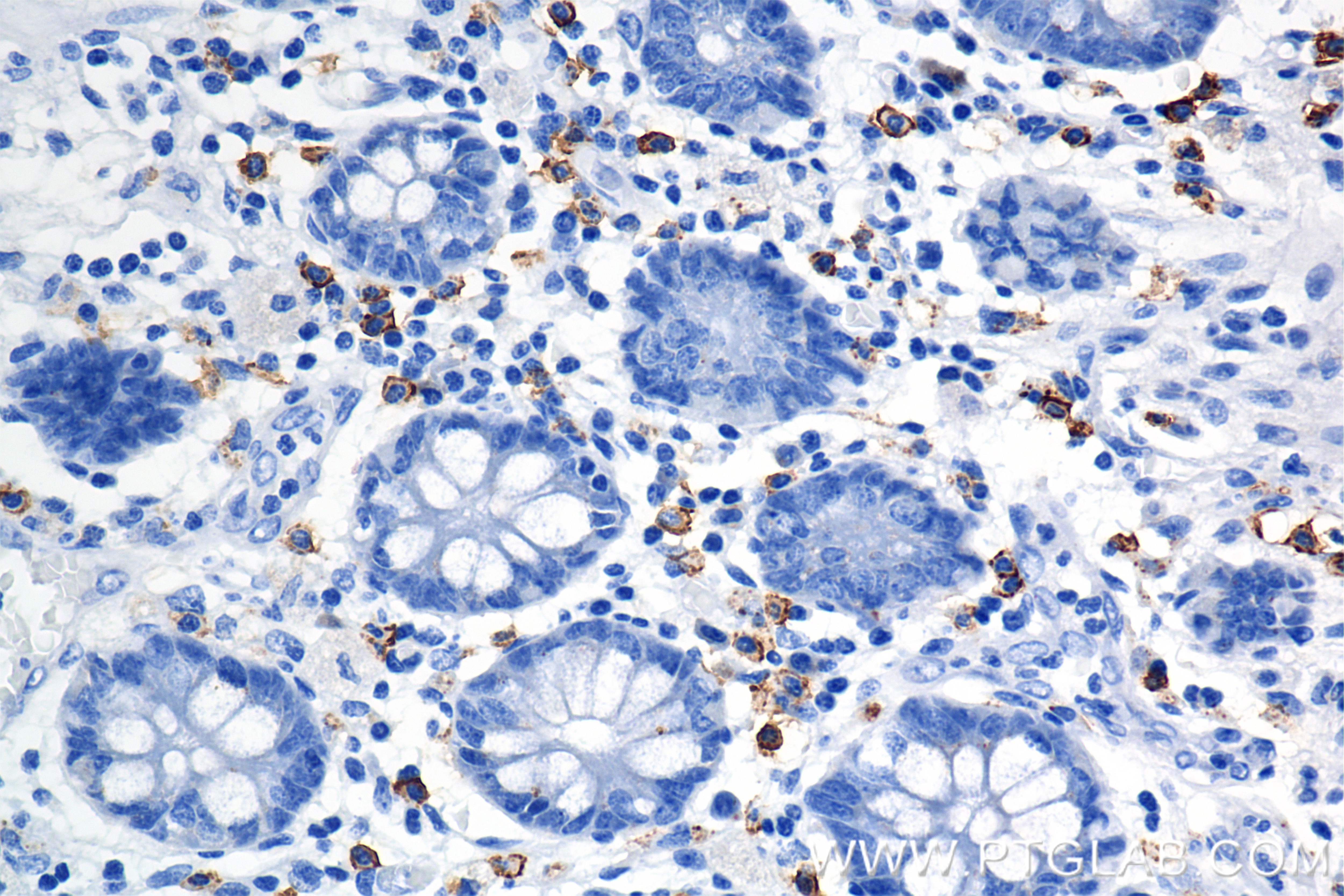 Immunohistochemical analysis of paraffin-embedded human colon tissue slide using 84259-10-RR (C-Kit antibody) at dilution of 1:5000 (under 40x lens). Heat mediated antigen retrieval with Sodium Citrate buffer (pH 6.0). Immunohistochemistry (IHC) staining of human colon tissue using CD117/c-Kit Recombinant antibody (84259-10-RR)