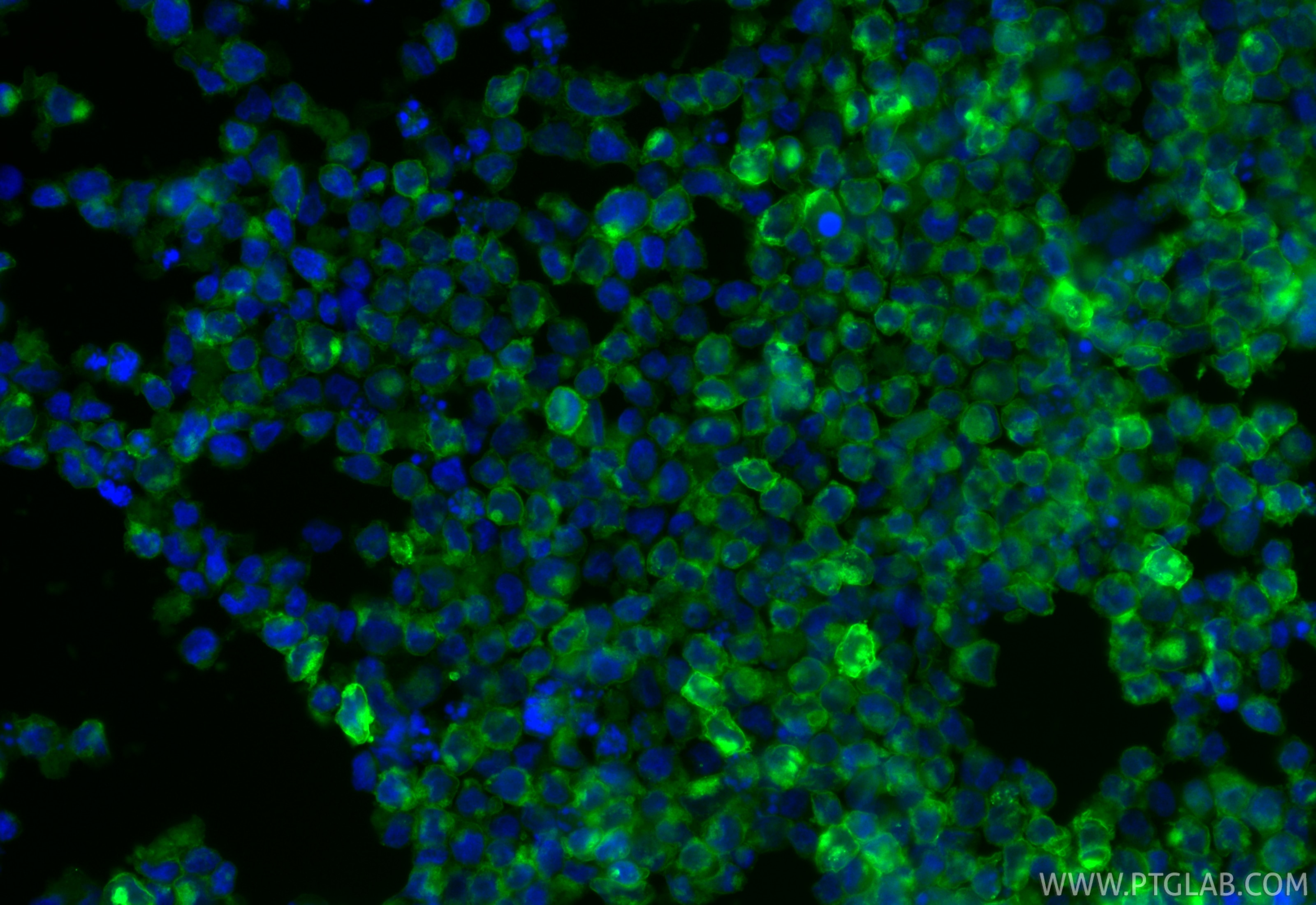 IF Staining of Mo7e using CL488-84259-3 Immunofluorescence (IF) / fluorescent staining of Mo7e cells using CoraLite® Plus 488-conjugated CD117/c-Kit Recombin (CL488-84259-3)