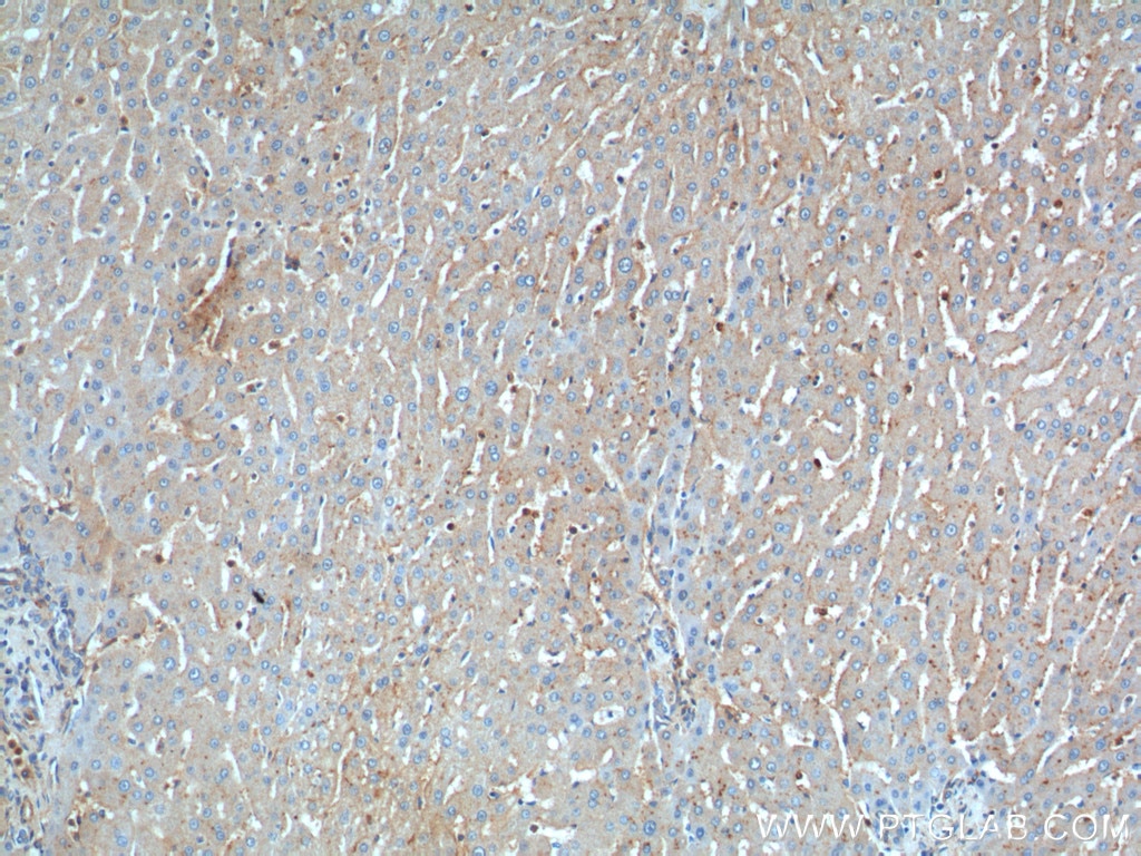 Immunohistochemistry (IHC) staining of human liver tissue using CD11B/Integrin Alpha M Polyclonal antibody (20991-1-AP)