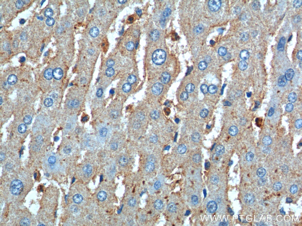 Immunohistochemistry (IHC) staining of human liver tissue using CD11B/Integrin Alpha M Polyclonal antibody (20991-1-AP)