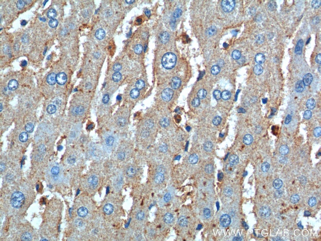 Immunohistochemistry (IHC) staining of human liver tissue using CD11B/Integrin Alpha M Polyclonal antibody (20991-1-AP)