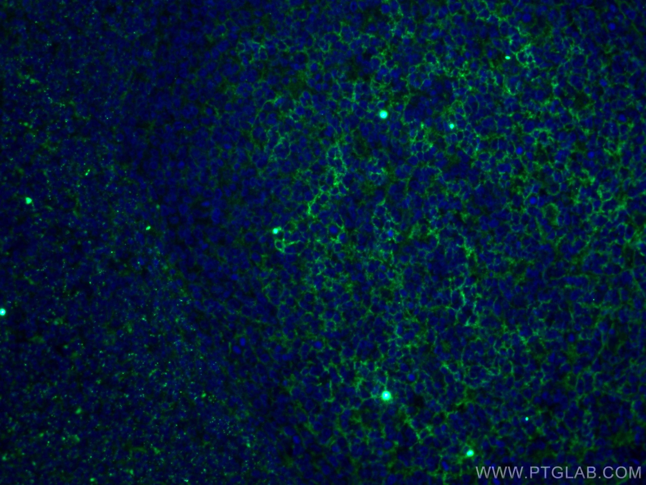 Immunofluorescence (IF) / fluorescent staining of human tonsillitis tissue using CD11B/Integrin Alpha M Monoclonal antibody (66519-1-Ig)