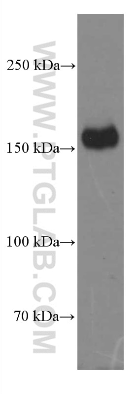 Western Blot (WB) analysis of THP-1 cells using CD11B/Integrin Alpha M Monoclonal antibody (66519-1-Ig)