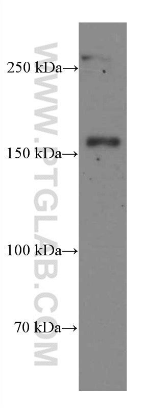 Western Blot (WB) analysis of human bone marrow tissue using CD11B/Integrin Alpha M Monoclonal antibody (66519-1-Ig)