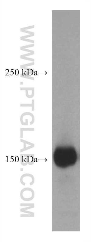 Western Blot (WB) analysis of TF-1 cells using CD11B/Integrin Alpha M Monoclonal antibody (66519-1-Ig)