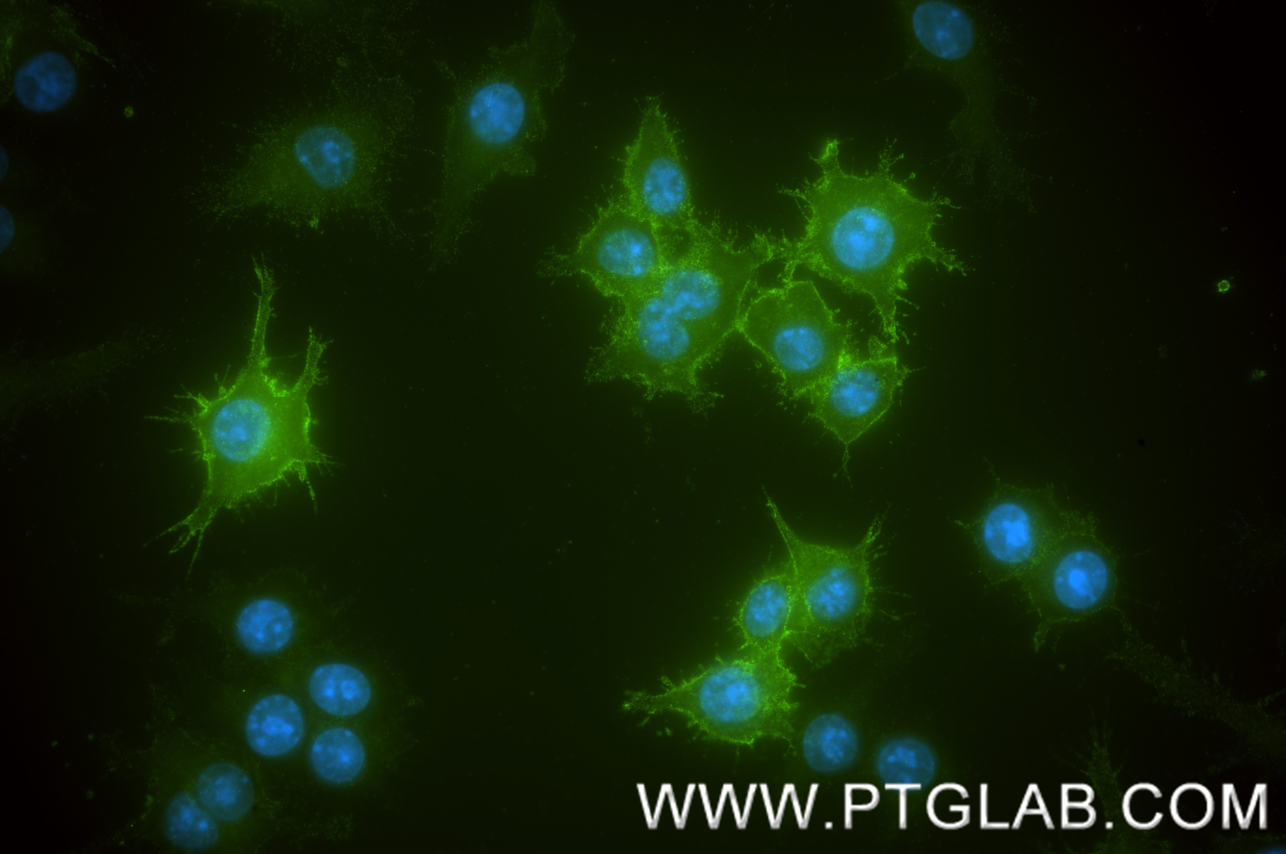 Immunofluorescence (IF) / fluorescent staining of RAW 264.7 cells using CD11a Recombinant monoclonal antibody (87542-1-RR)