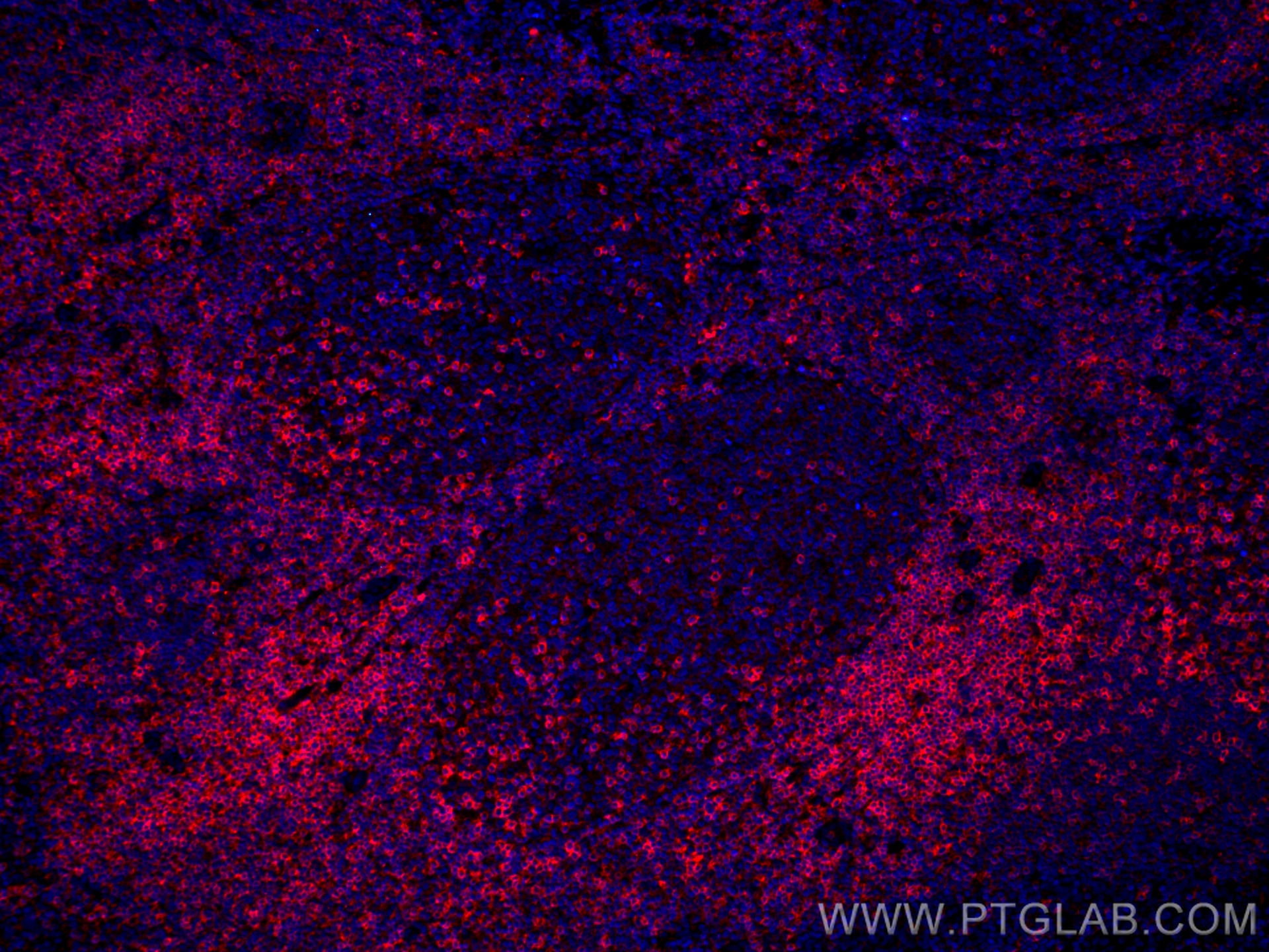 Immunofluorescence (IF) / fluorescent staining of human tonsillitis tissue using CoraLite®594-conjugated CD11a/Integrin Alpha L Mon (CL594-66256)