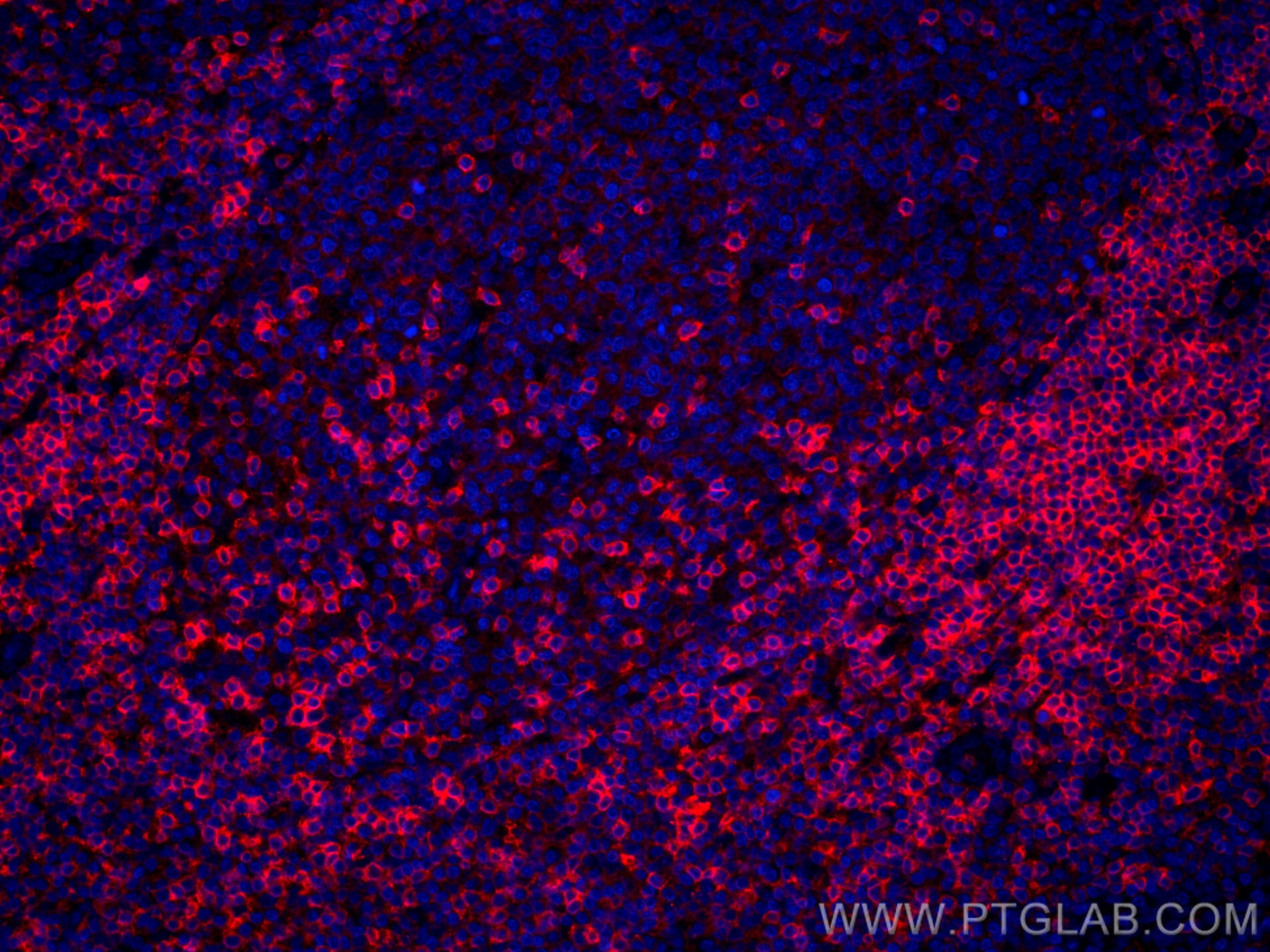 IF Staining of human tonsillitis using CL594-66256