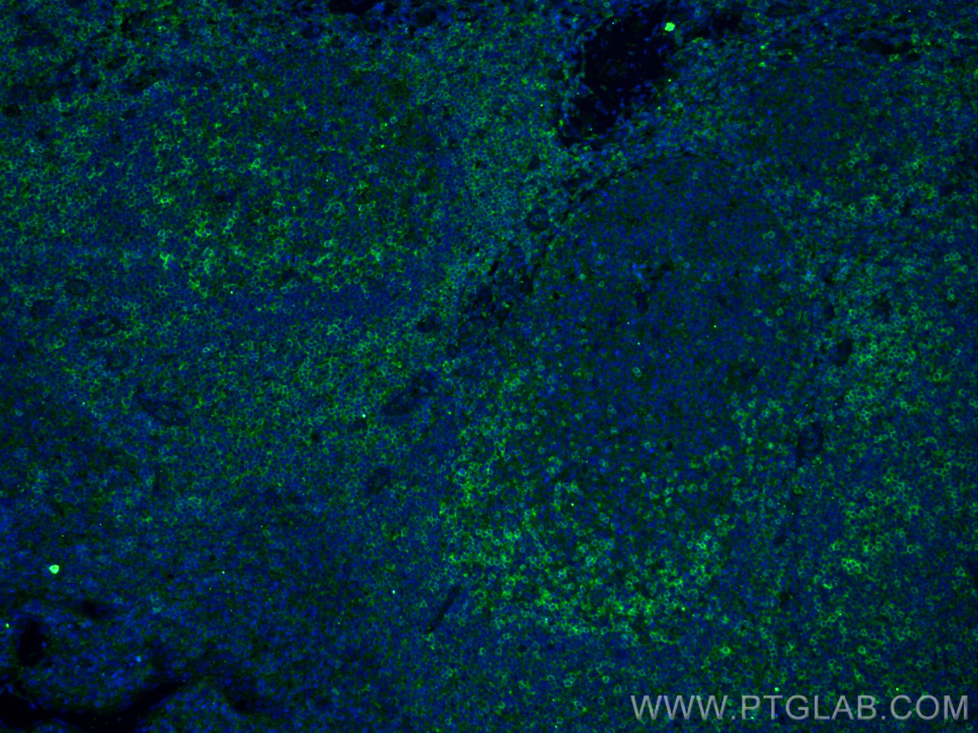 Immunofluorescence (IF) / fluorescent staining of human tonsillitis tissue using CD11a/Integrin Alpha L Monoclonal antibody (66256-1-Ig)