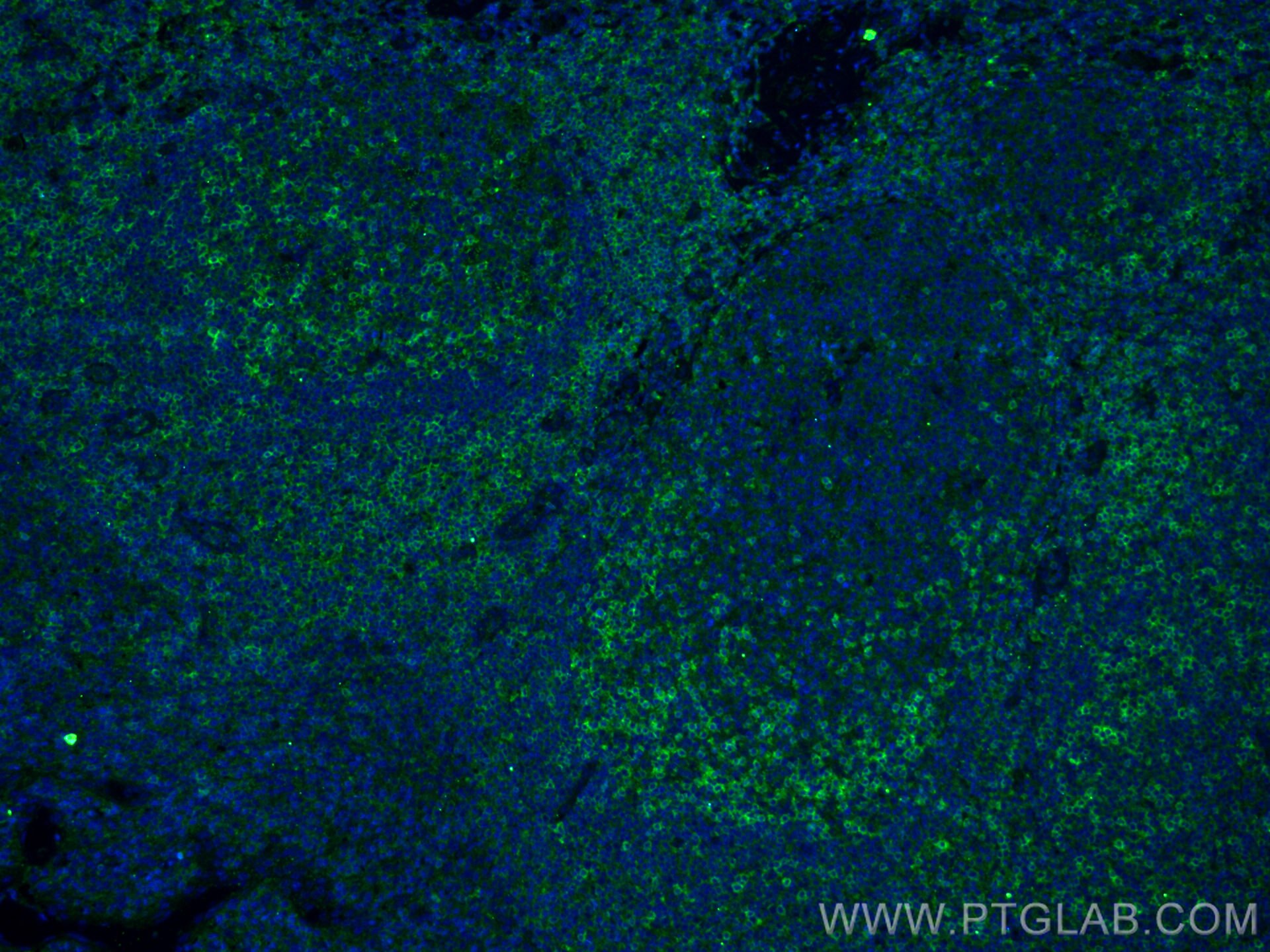 Immunofluorescence (IF) / fluorescent staining of human tonsillitis tissue using CD11a/Integrin Alpha L Monoclonal antibody (66256-1-Ig)