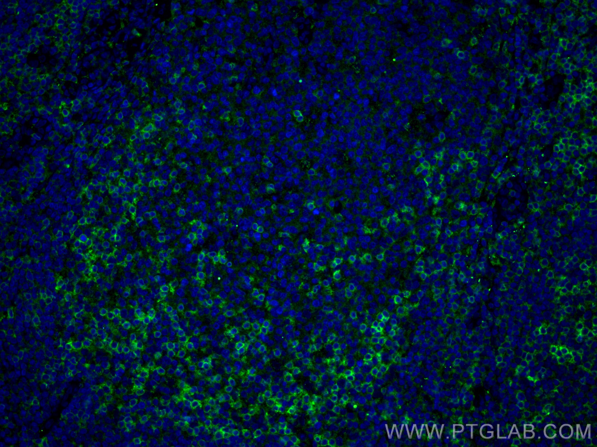 CD11a/Integrin Alpha L