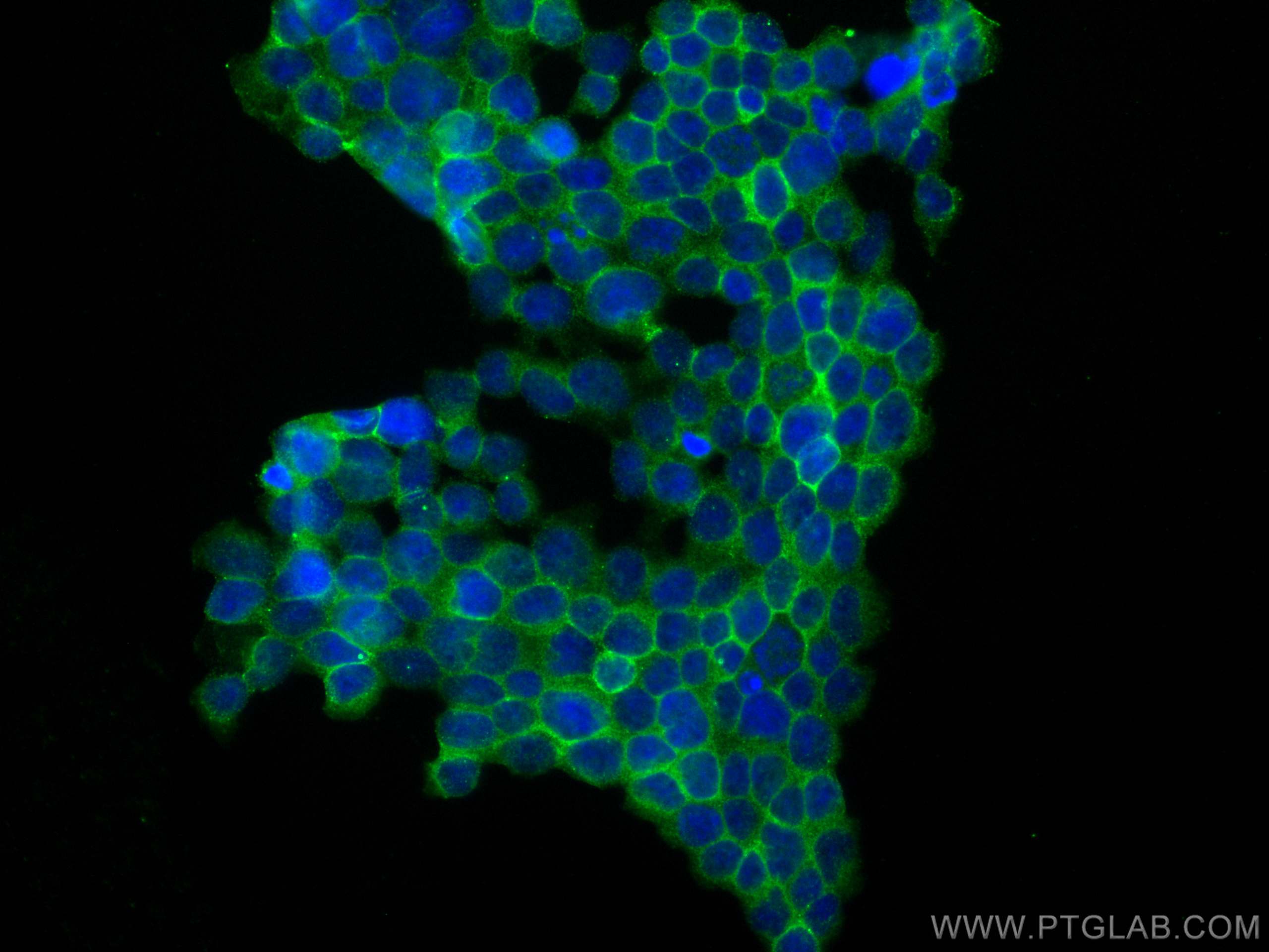 Immunofluorescence (IF) / fluorescent staining of Jurkat cells using CD11a/Integrin Alpha L Monoclonal antibody (66256-1-Ig)