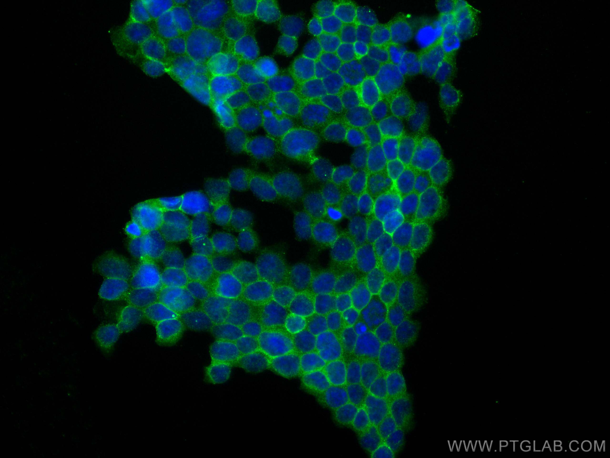 CD11a/Integrin Alpha L