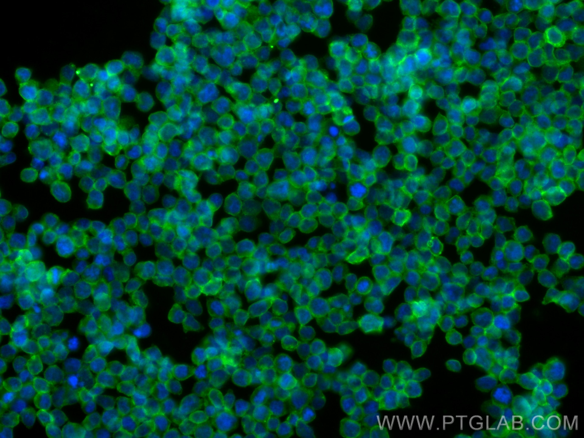 Immunofluorescence (IF) / fluorescent staining of Jurkat cells using CD11a/Integrin Alpha L Monoclonal antibody (66256-1-Ig)