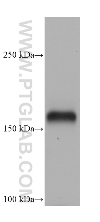 Western Blot (WB) analysis of Ramos cells using CD11a/Integrin Alpha L Monoclonal antibody (66256-1-Ig)