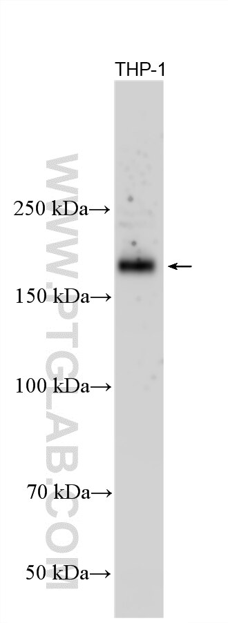 Western Blot (WB) analysis of various lysates using CD11a Monoclonal antibody (66256-1-Ig)