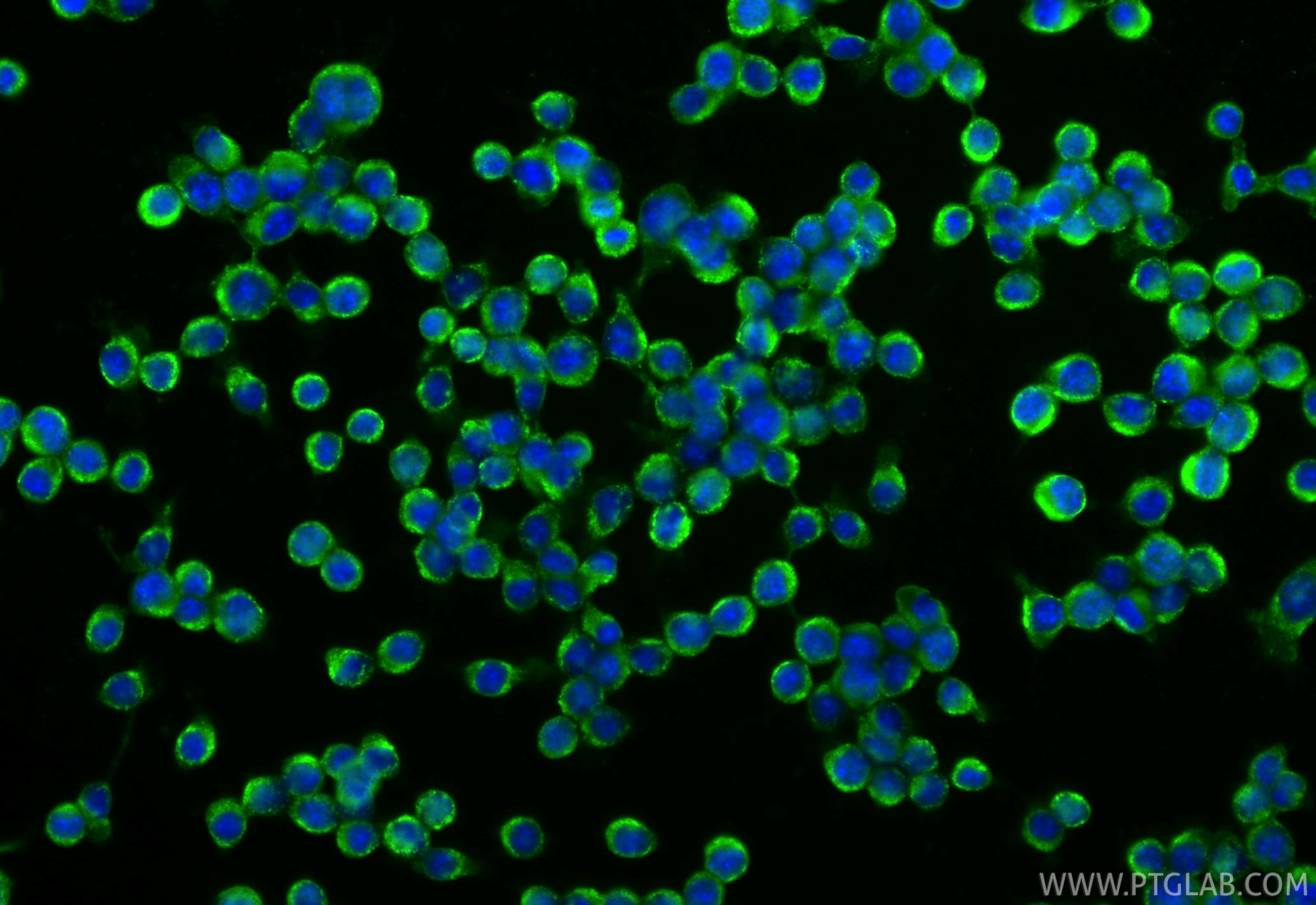 Immunofluorescence (IF) / fluorescent staining of BV-2 cells using CD11b Polyclonal antibody (31745-1-AP)